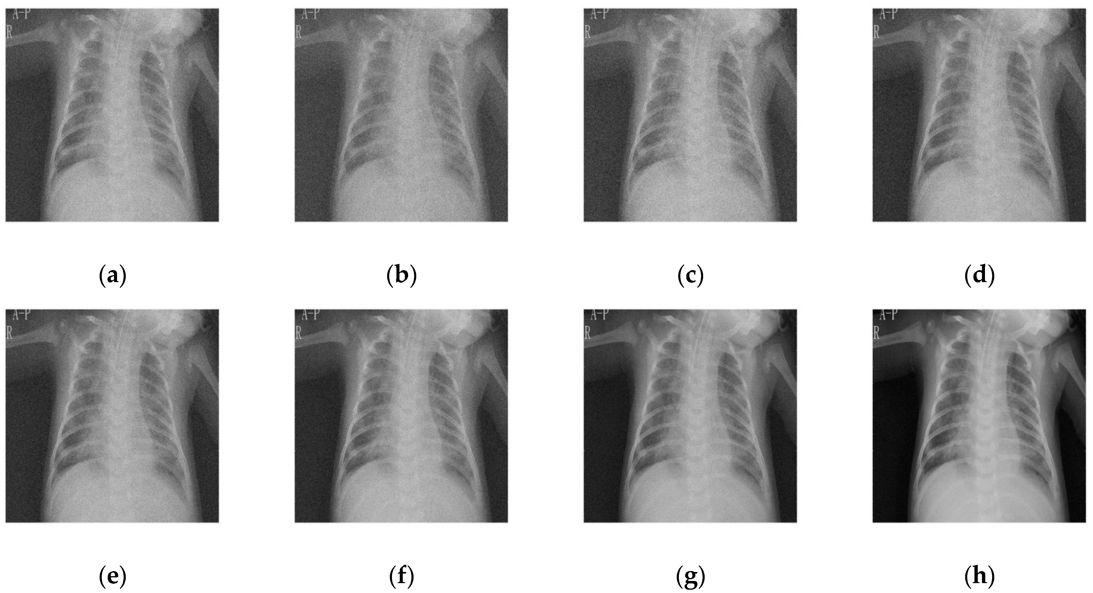 Diagnostics 12 02766 g006 Diagnostics 12 02766 g006