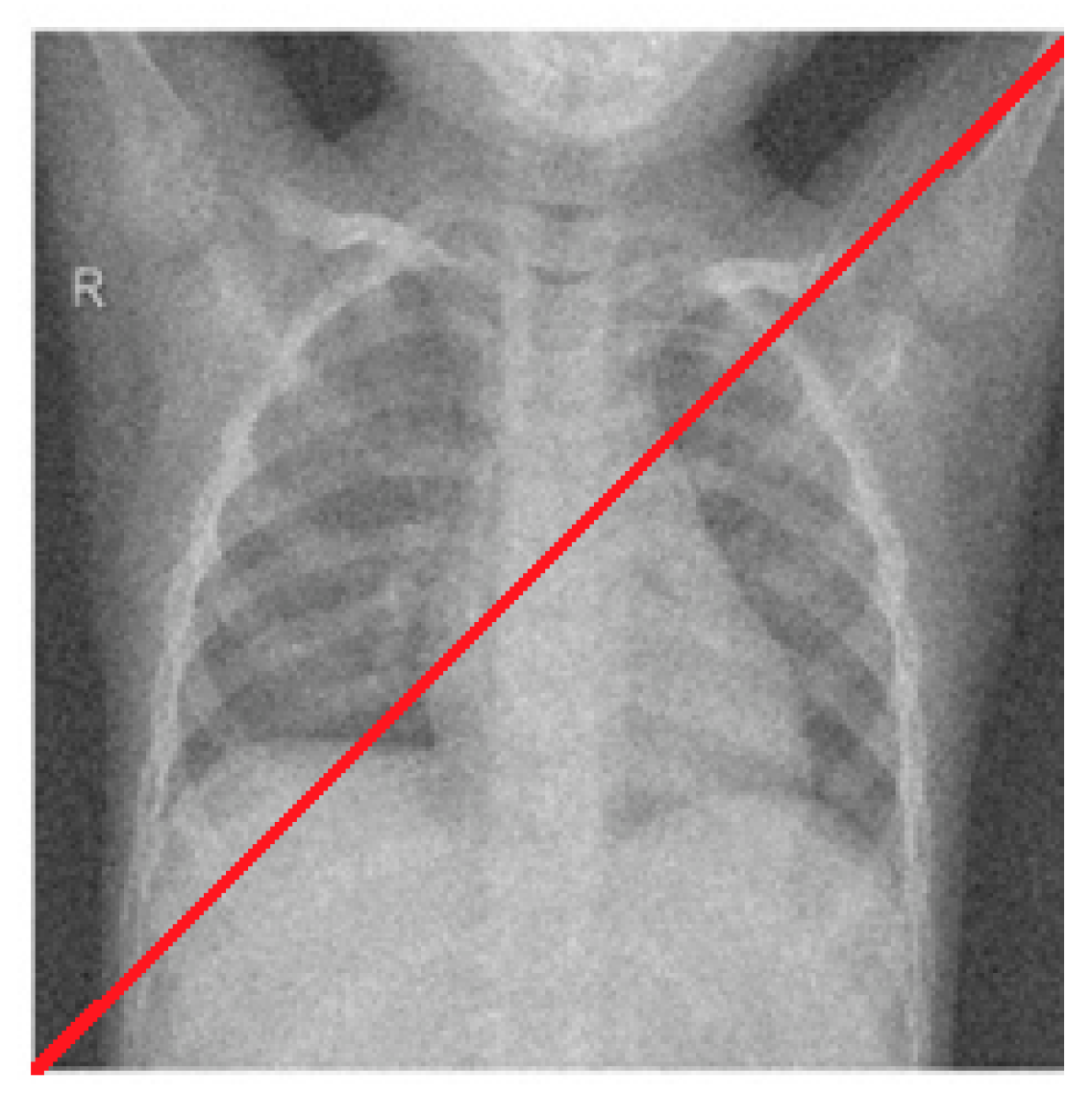 Diagnostics 12 02766 g008 Diagnostics 12 02766 g008