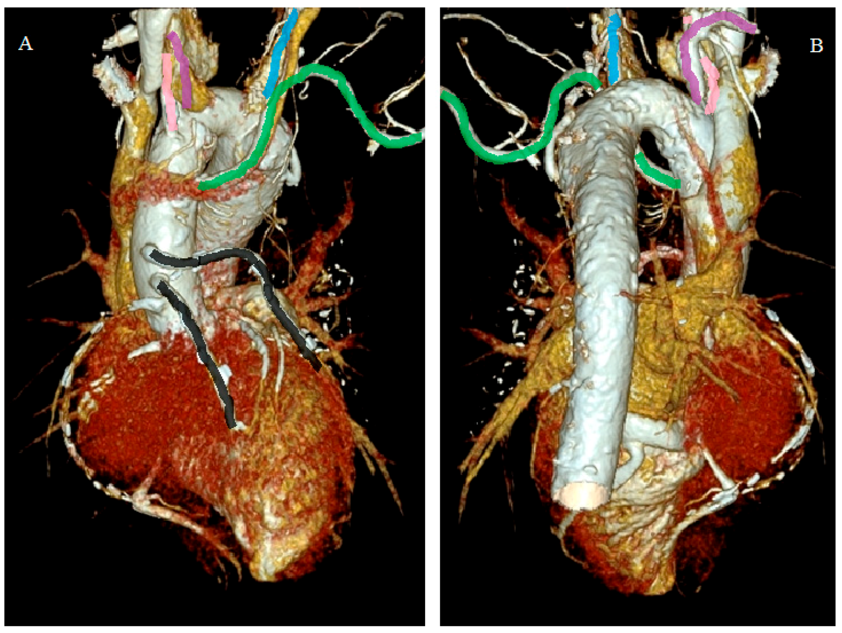 Diagnostics 12 02773 g004 Diagnostics 12 02773 g004