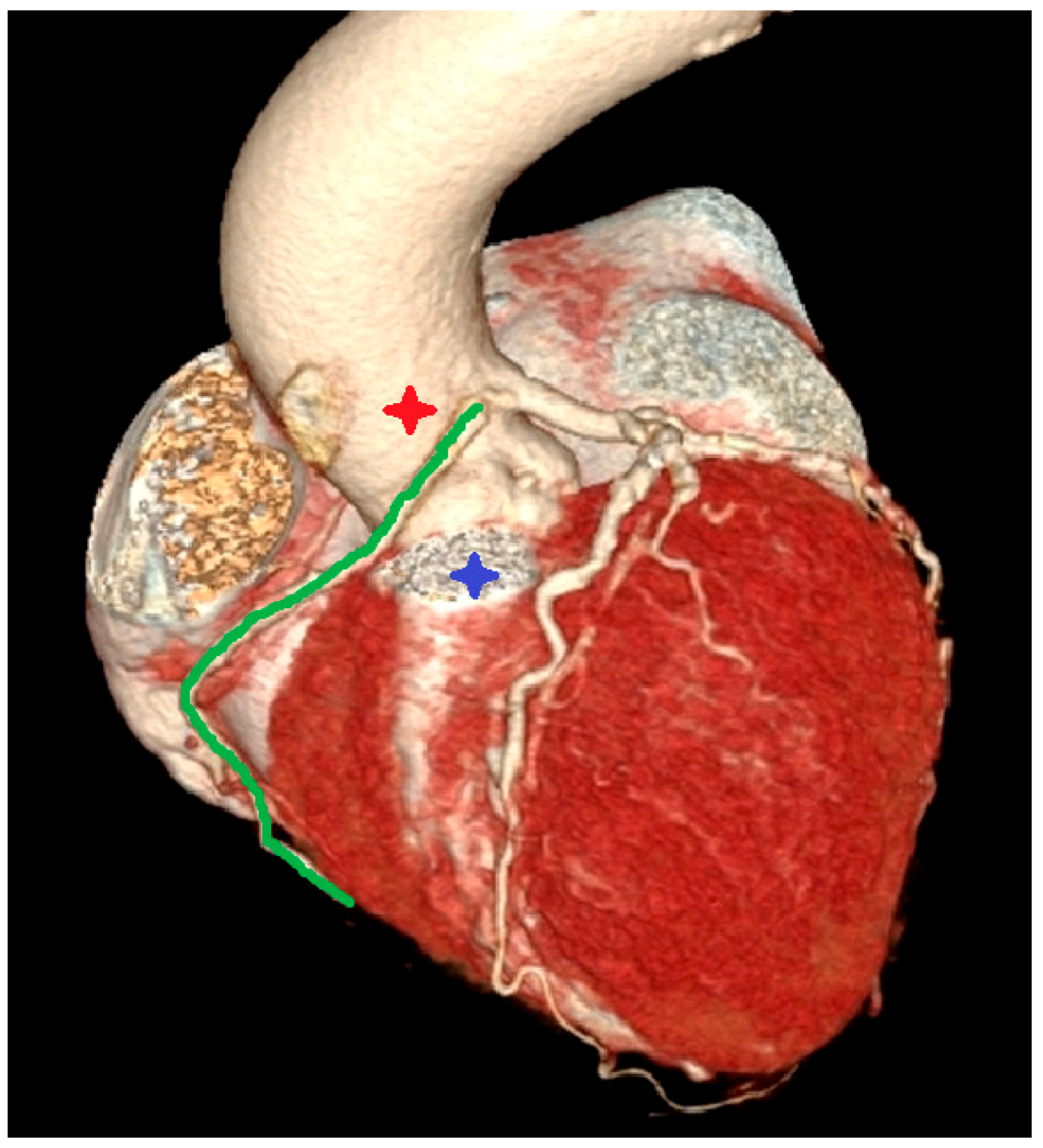 Diagnostics 12 02773 g006 Diagnostics 12 02773 g006
