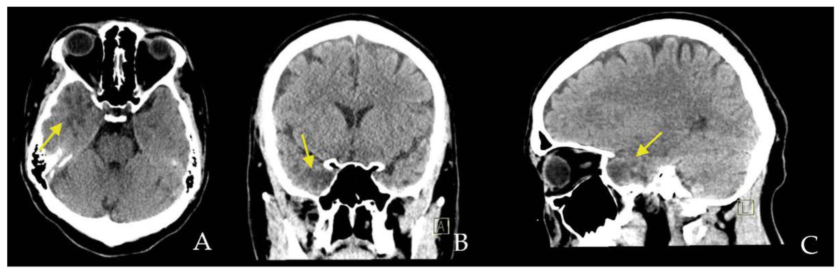 Diagnostics 12 02779 g001 Diagnostics 12 02779 g001
