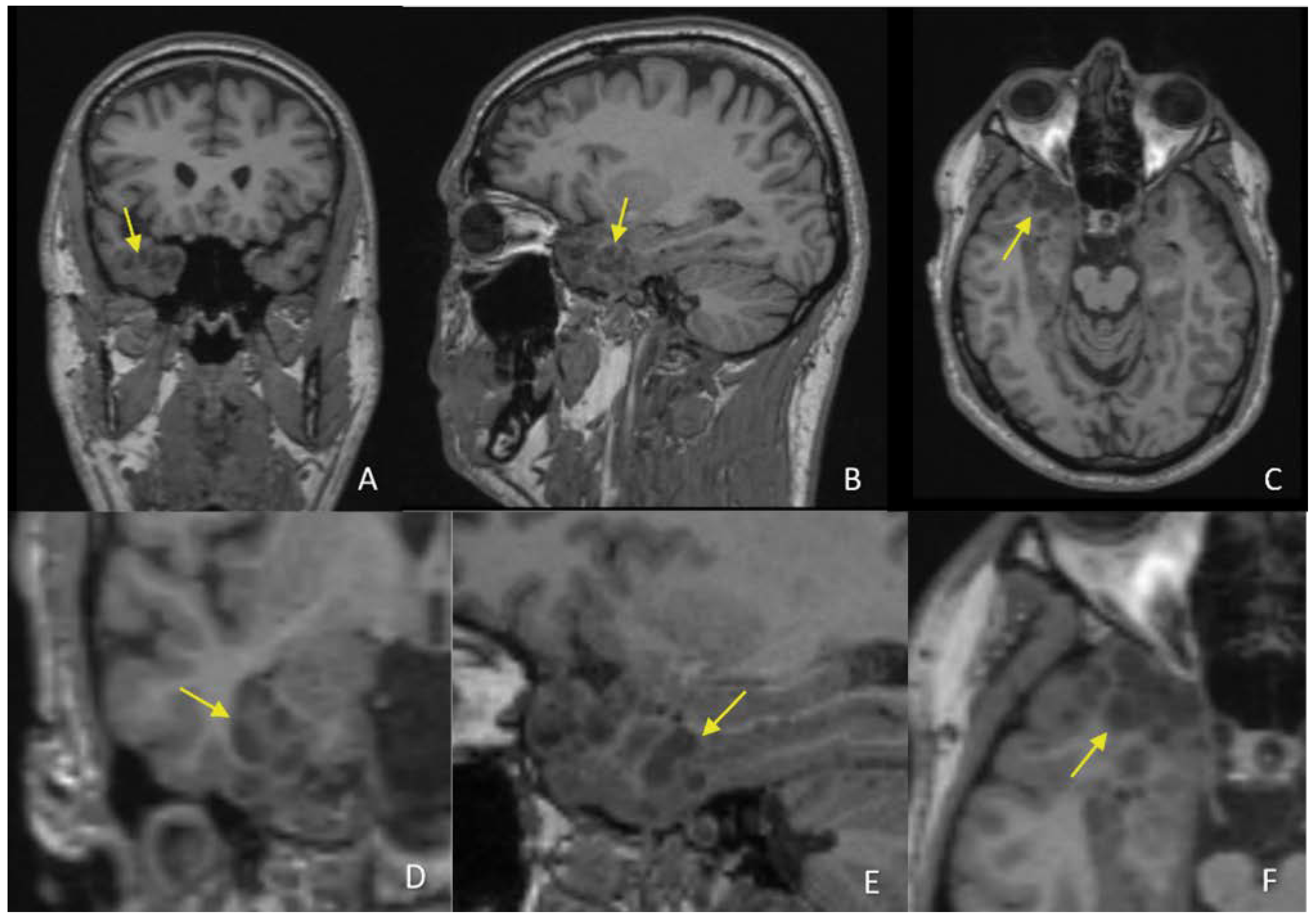 Diagnostics 12 02779 g002 Diagnostics 12 02779 g002