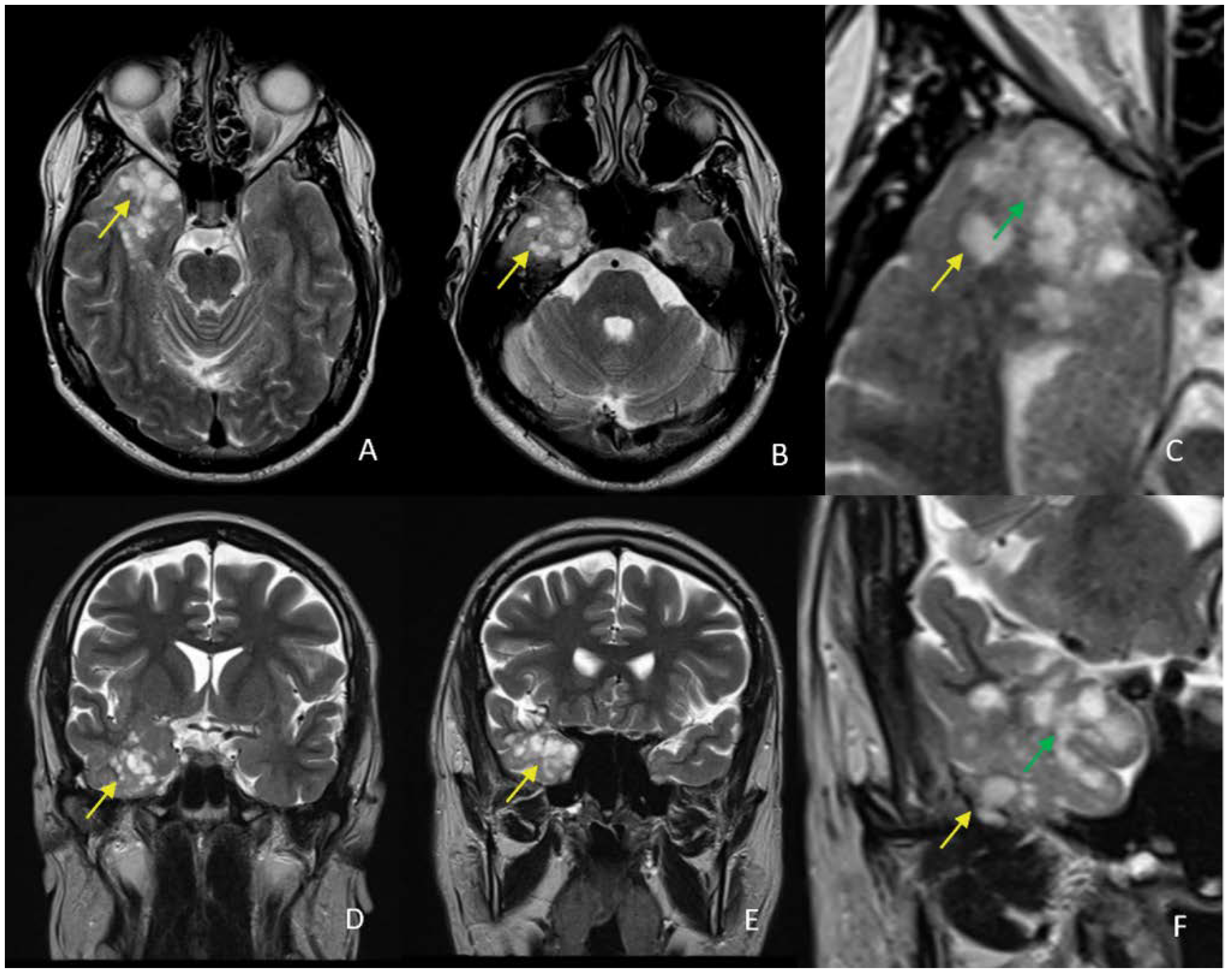 Diagnostics 12 02779 g003 Diagnostics 12 02779 g003