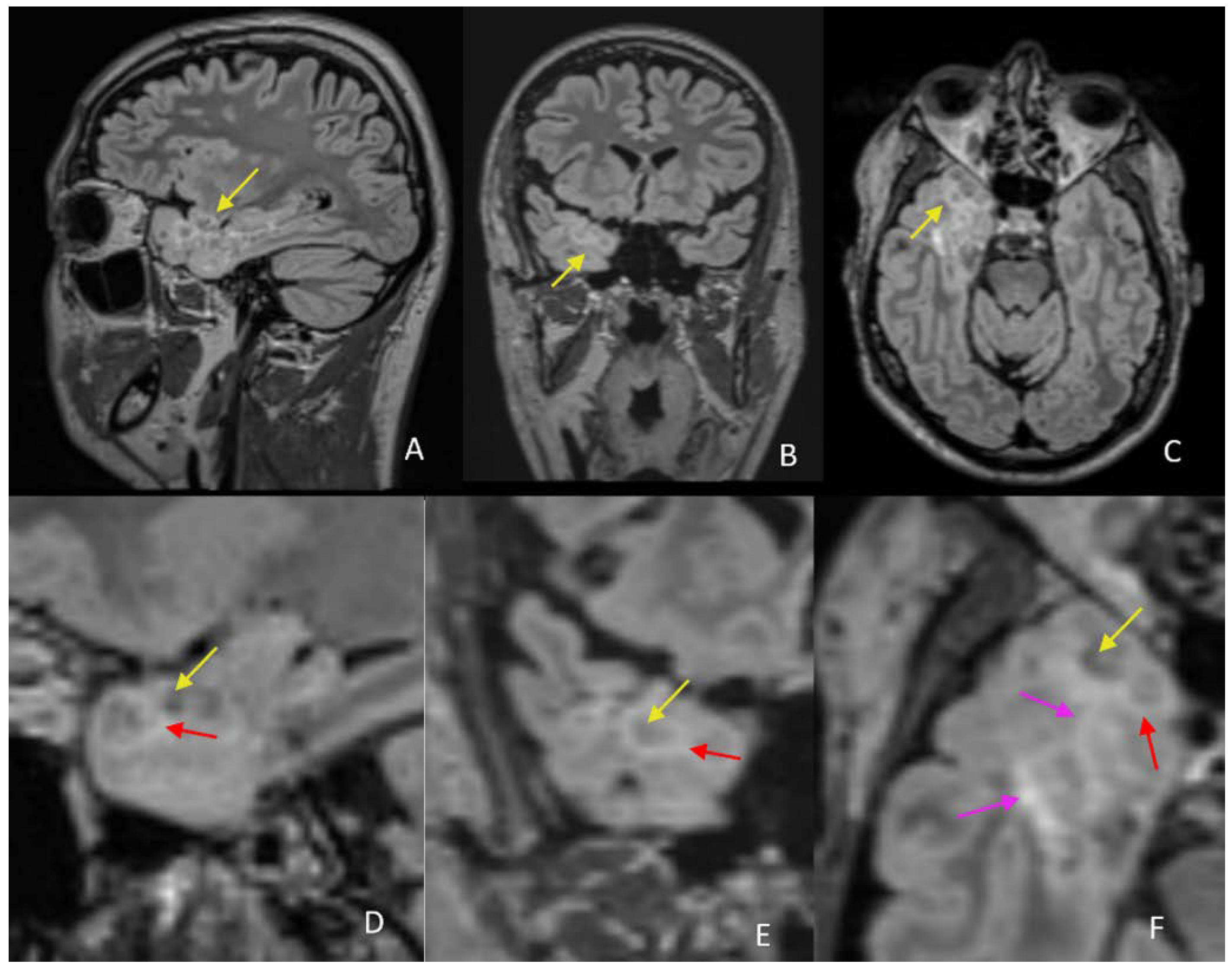 Diagnostics 12 02779 g005 Diagnostics 12 02779 g005