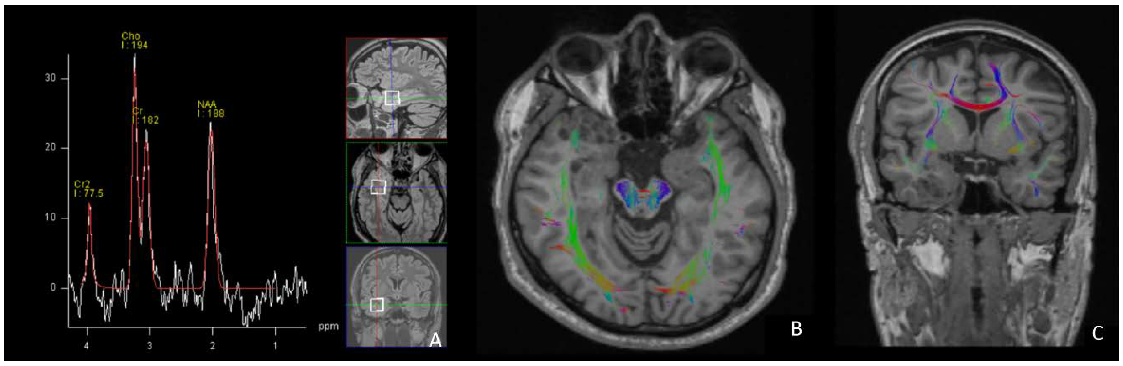 Diagnostics 12 02779 g006 Diagnostics 12 02779 g006