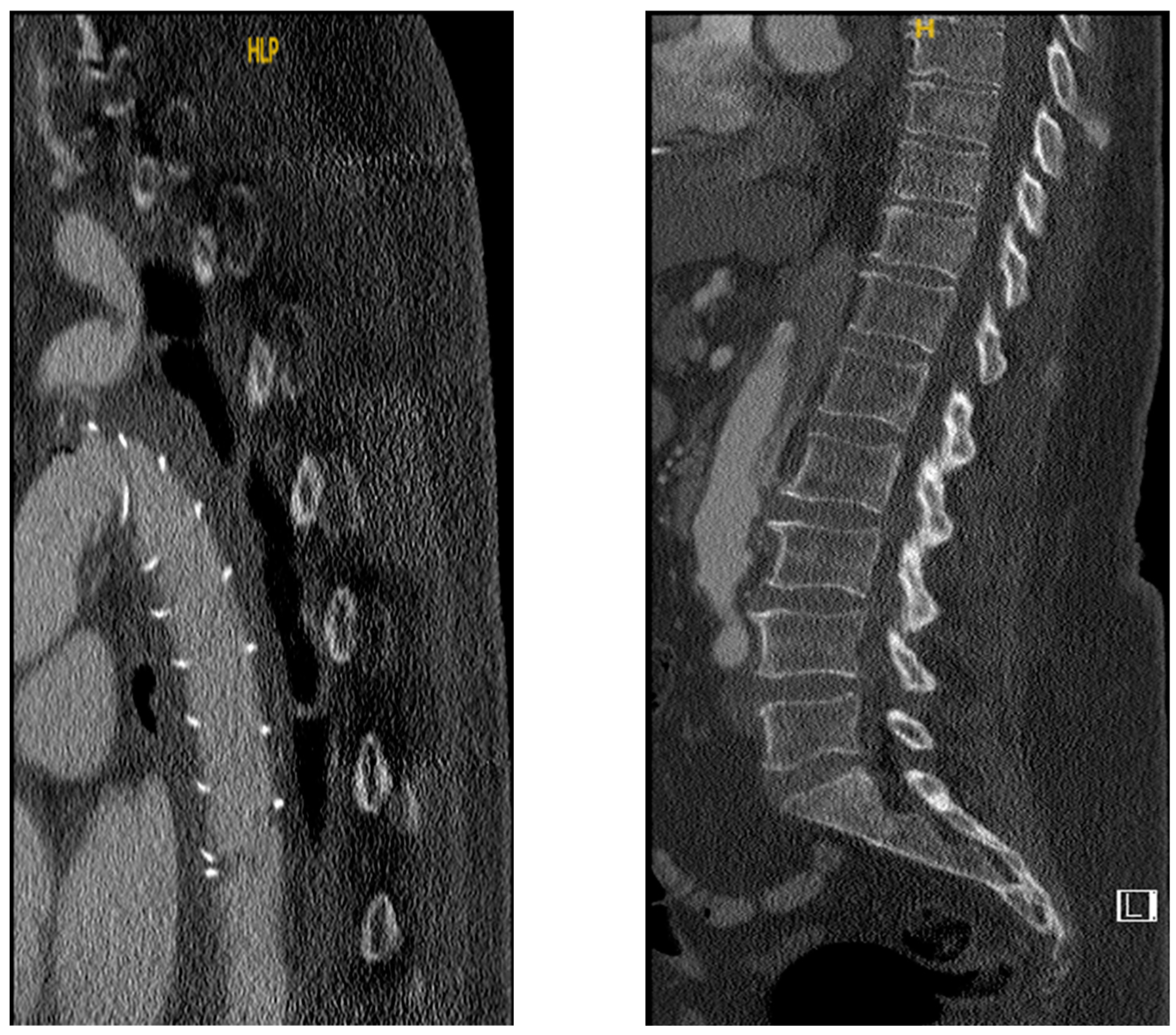 Diagnostics 12 02781 g003 Diagnostics 12 02781 g003