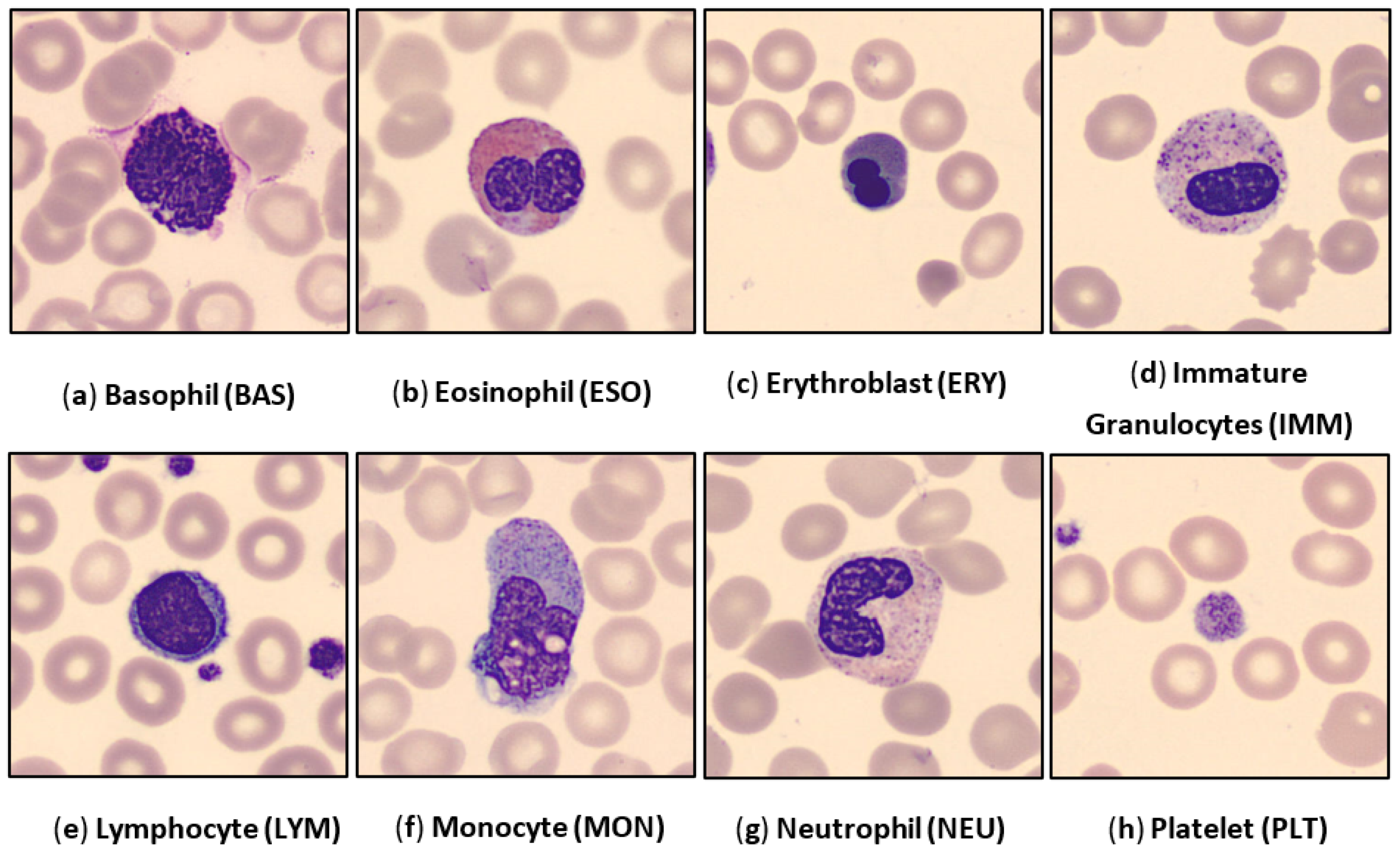 Basophils Neutrophils Lymphocytes Monocytes Eosinophils