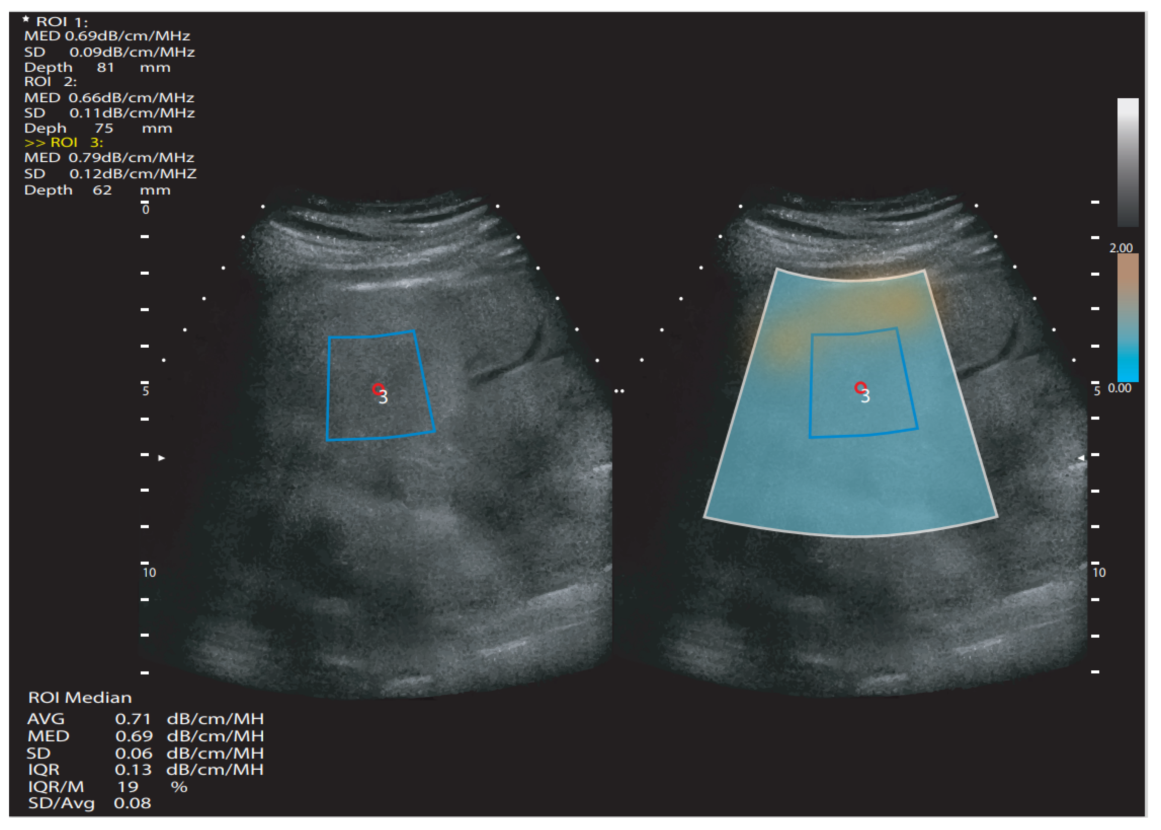 Diagnostics 12 02822 g002 Diagnostics 12 02822 g002