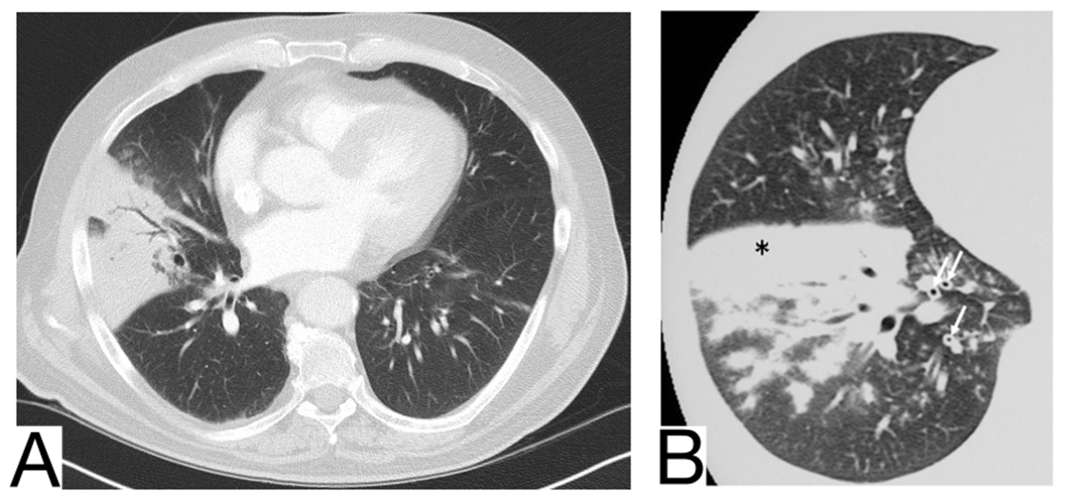 Diagnostics 12 02823 g005 Diagnostics 12 02823 g005