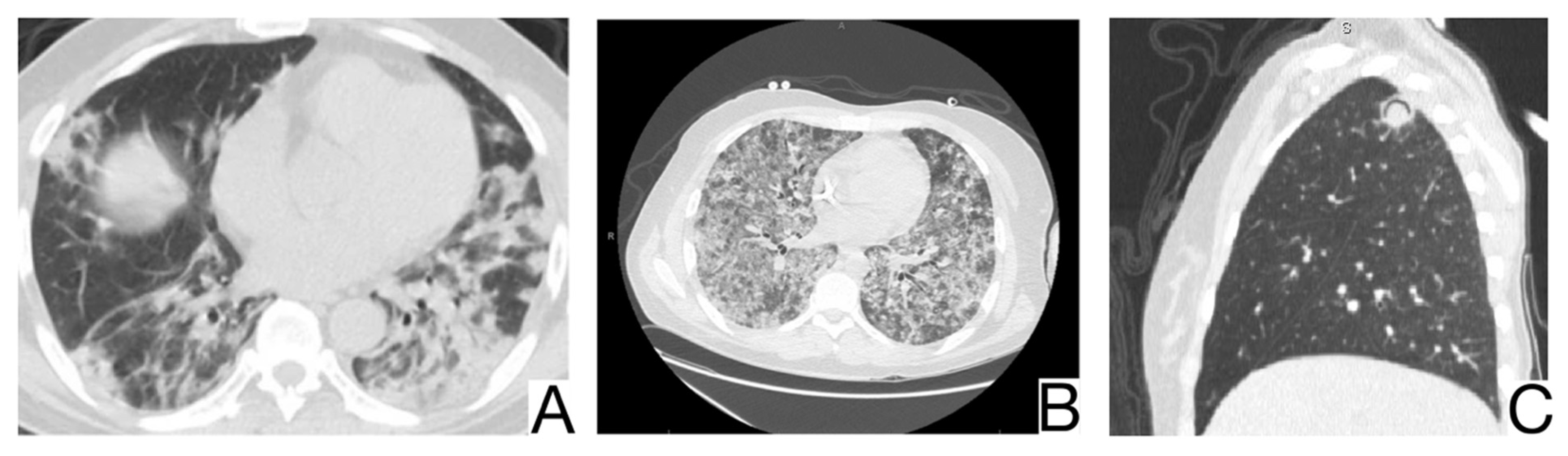 Diagnostics 12 02823 g006 Diagnostics 12 02823 g006