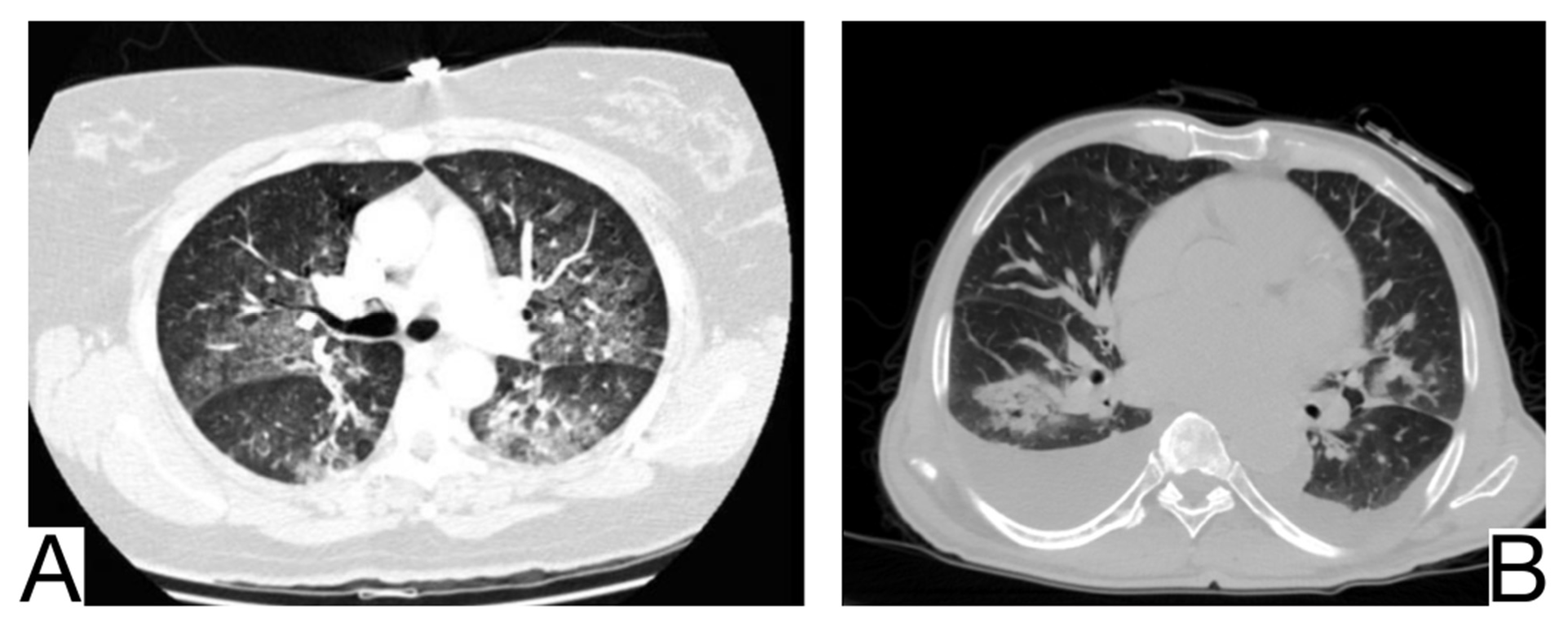 Diagnostics 12 02823 g007 Diagnostics 12 02823 g007