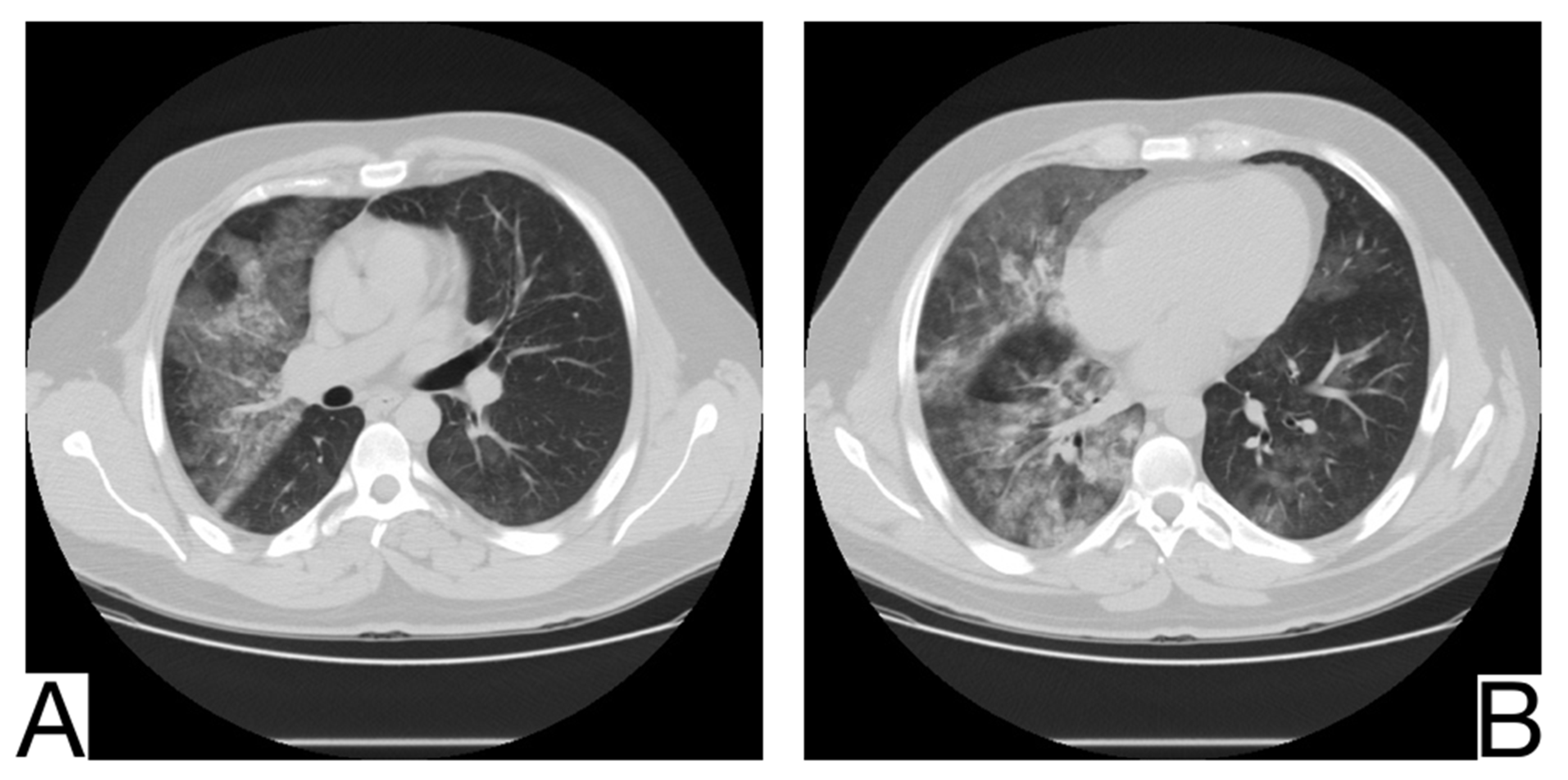 Diagnostics 12 02823 g008 Diagnostics 12 02823 g008