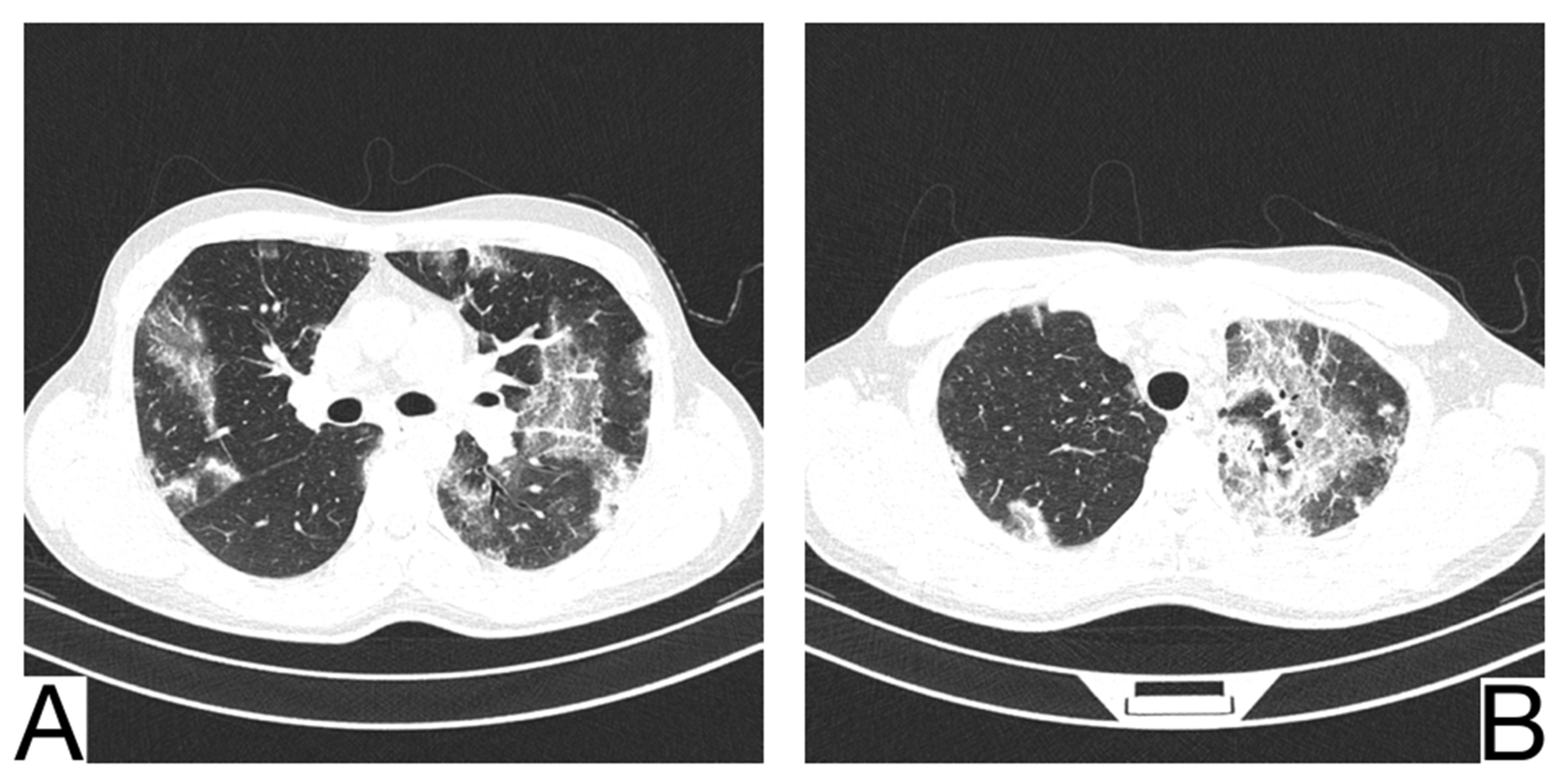 Diagnostics 12 02823 g010 Diagnostics 12 02823 g010
