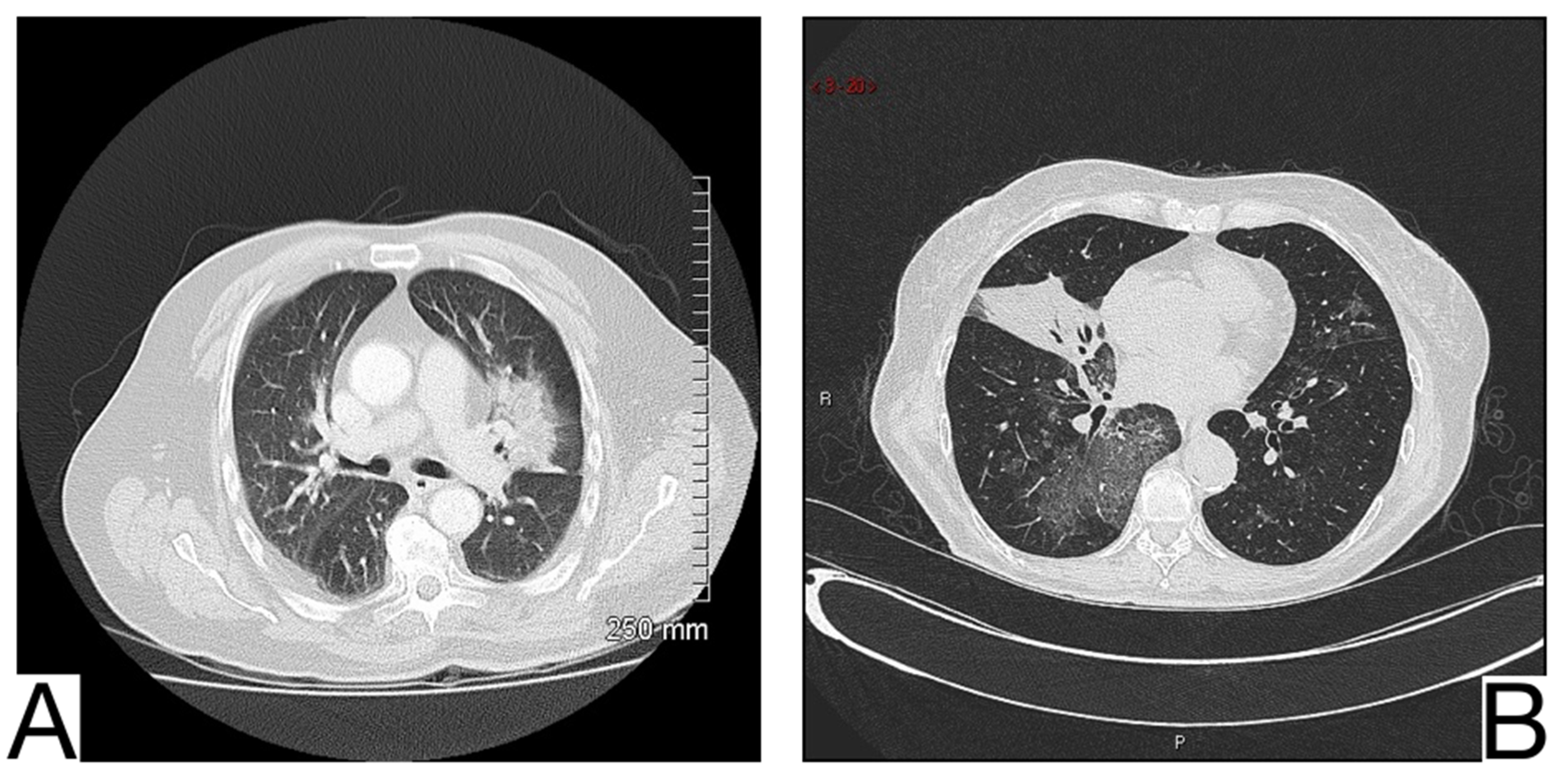 Diagnostics 12 02823 g011 Diagnostics 12 02823 g011
