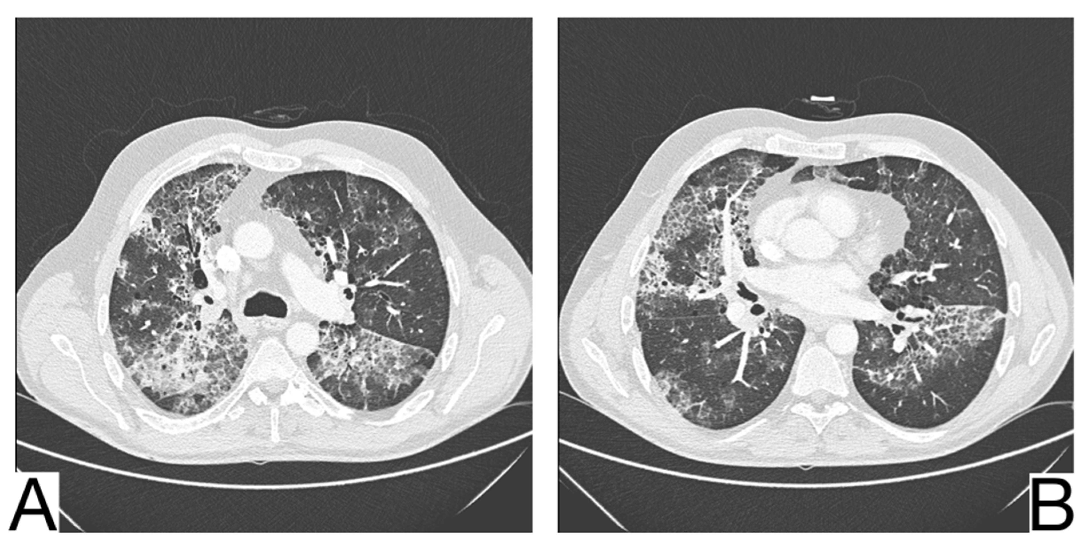 Diagnostics 12 02823 g012 Diagnostics 12 02823 g012