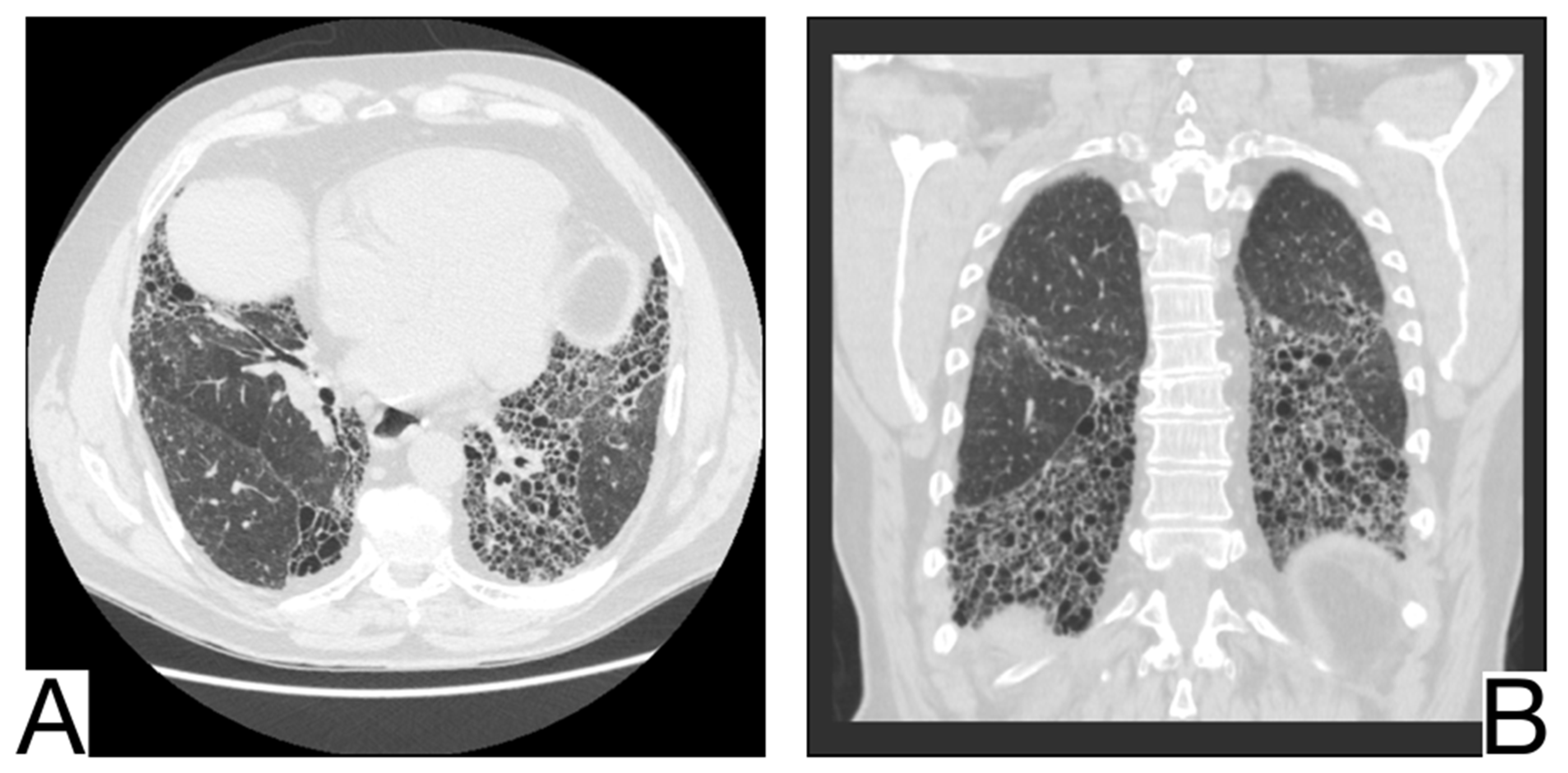 Diagnostics 12 02823 g013 Diagnostics 12 02823 g013