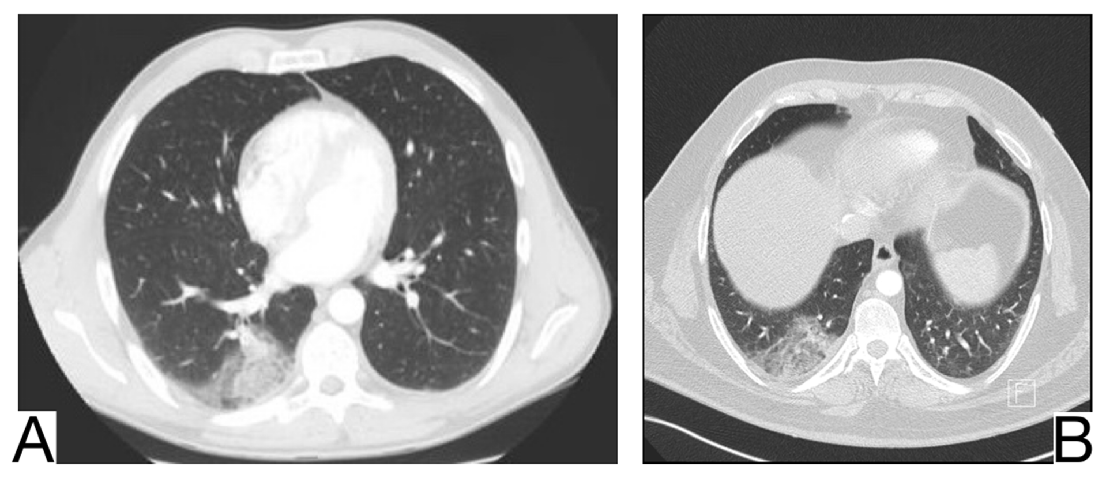 Diagnostics 12 02823 g014 Diagnostics 12 02823 g014