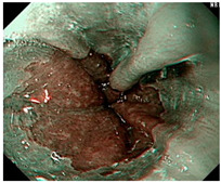 Diagnostics 12 02827 i004