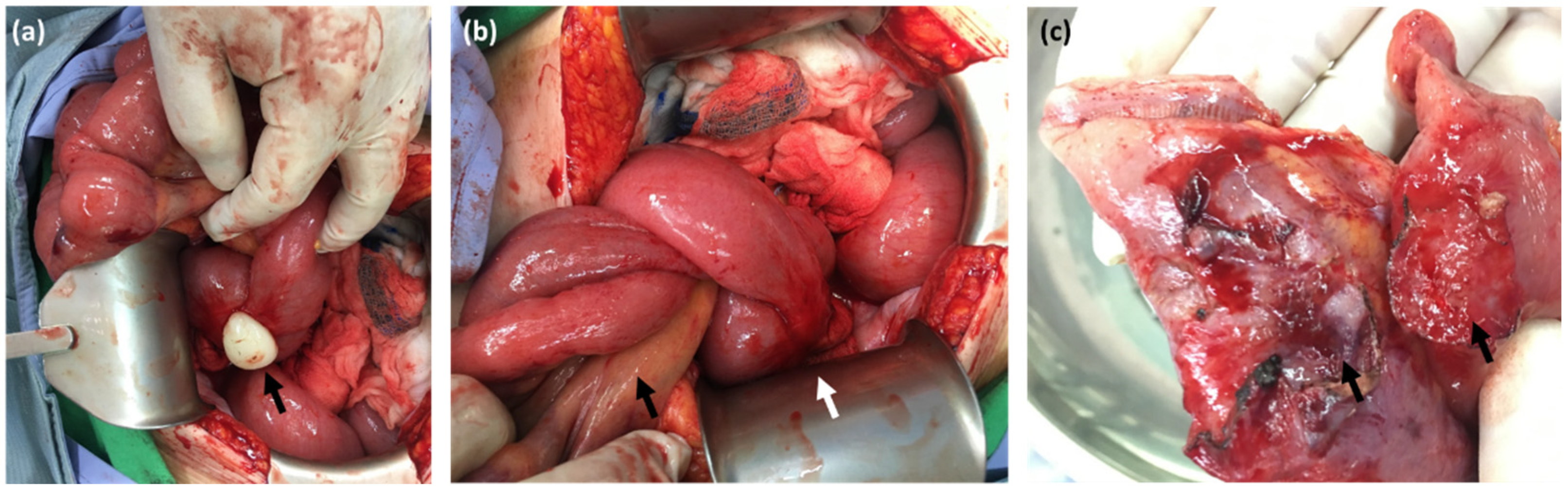 Diagnostics 12 02832 g003