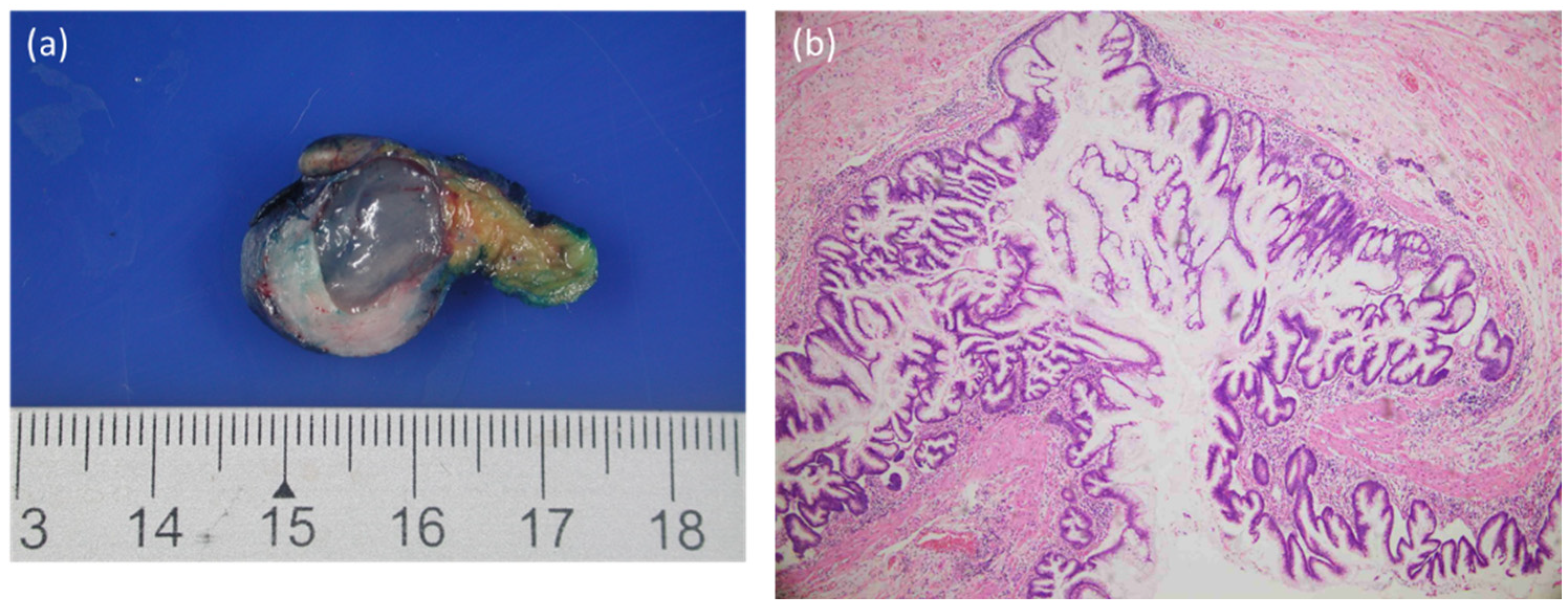 Diagnostics 12 02832 g004
