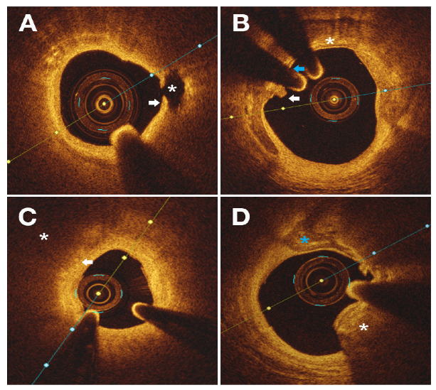 Diagnostics 12 02837 g002 Diagnostics 12 02837 g002