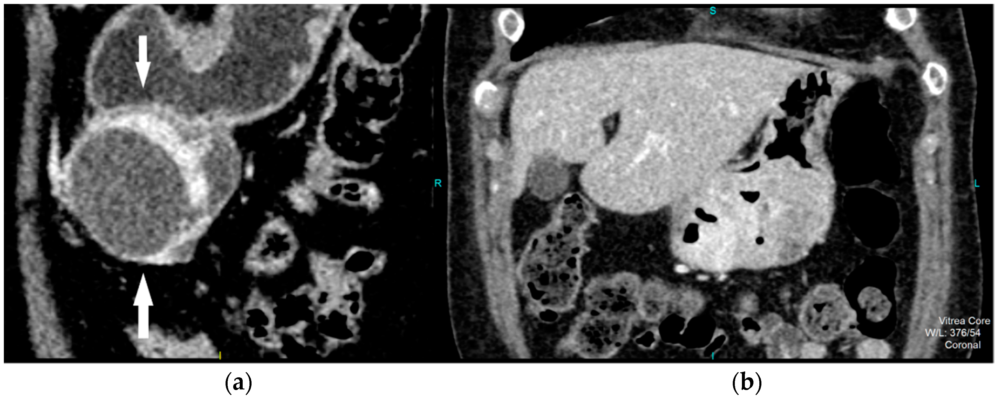 Diagnostics 12 02841 g002