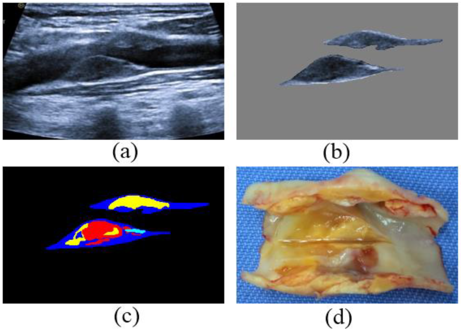 Diagnostics 12 02852 g001 Diagnostics 12 02852 g001