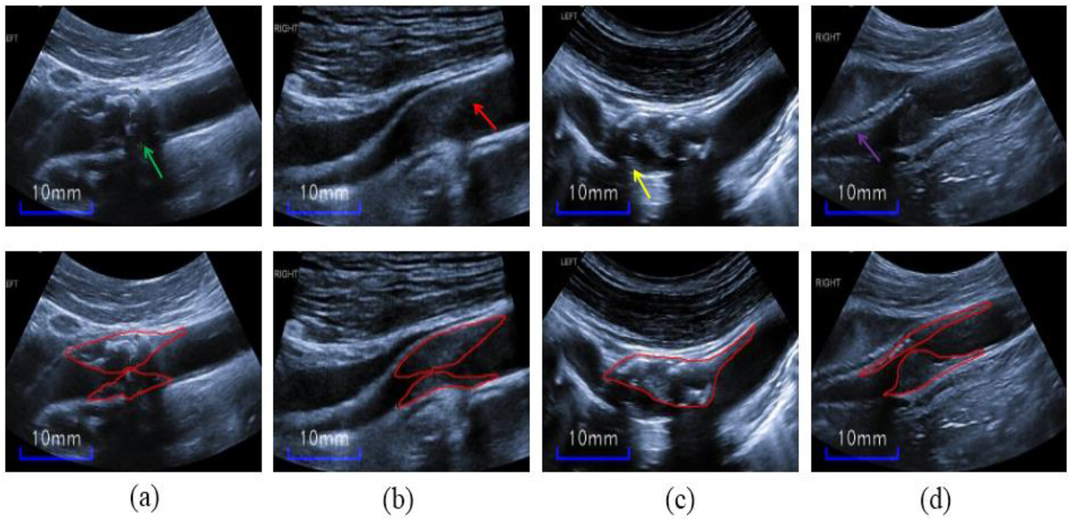 Diagnostics 12 02852 g002 Diagnostics 12 02852 g002