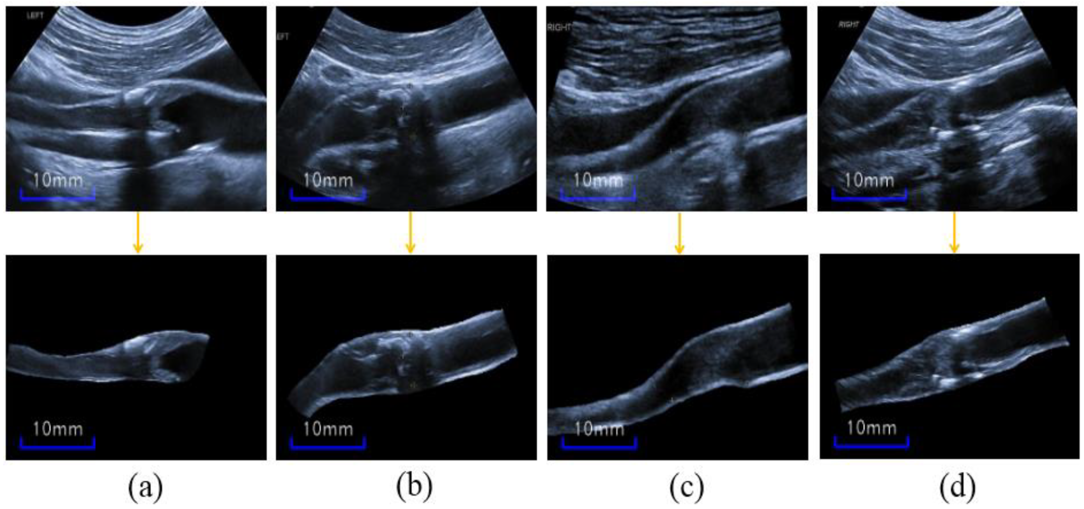 Diagnostics 12 02852 g004 Diagnostics 12 02852 g004