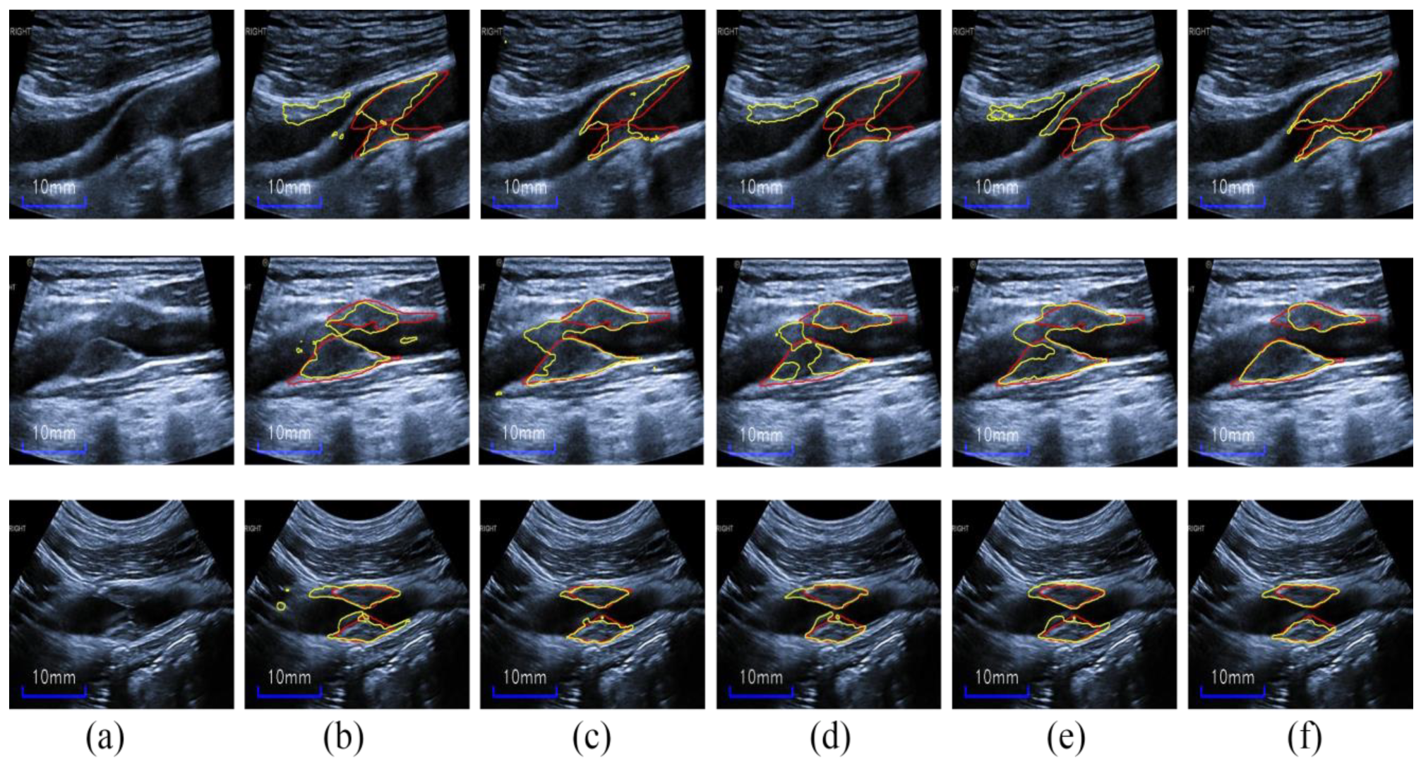 Diagnostics 12 02852 g009 Diagnostics 12 02852 g009