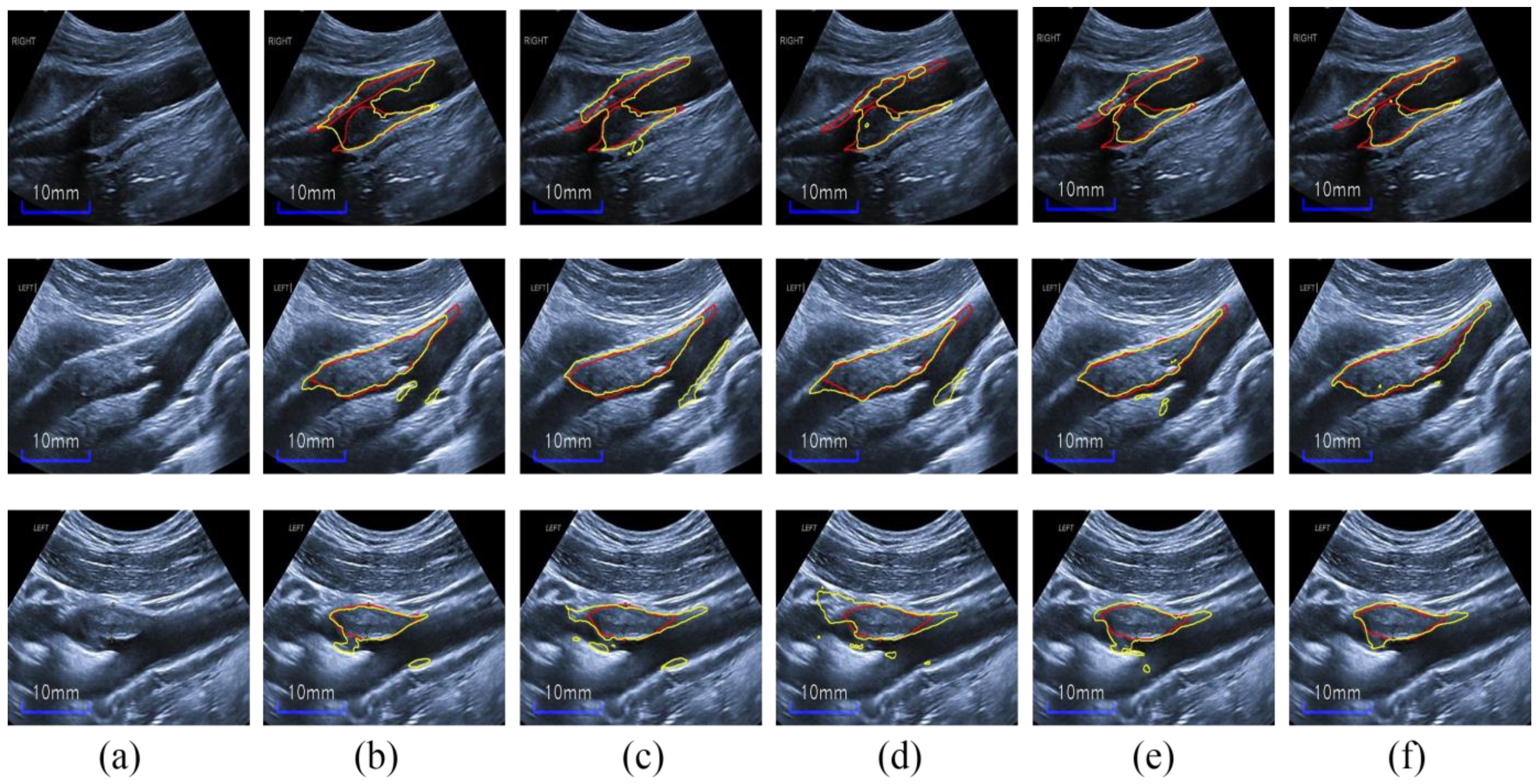 Diagnostics 12 02852 g010 Diagnostics 12 02852 g010