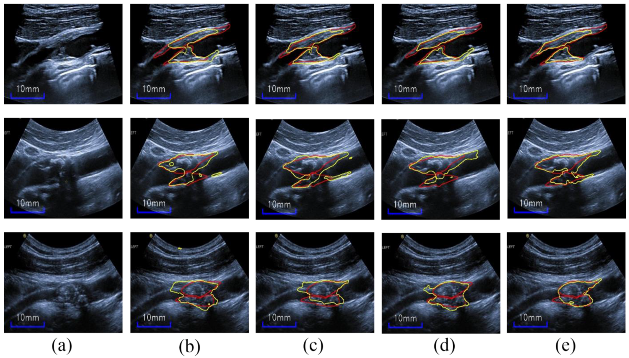 Diagnostics 12 02852 g012 Diagnostics 12 02852 g012