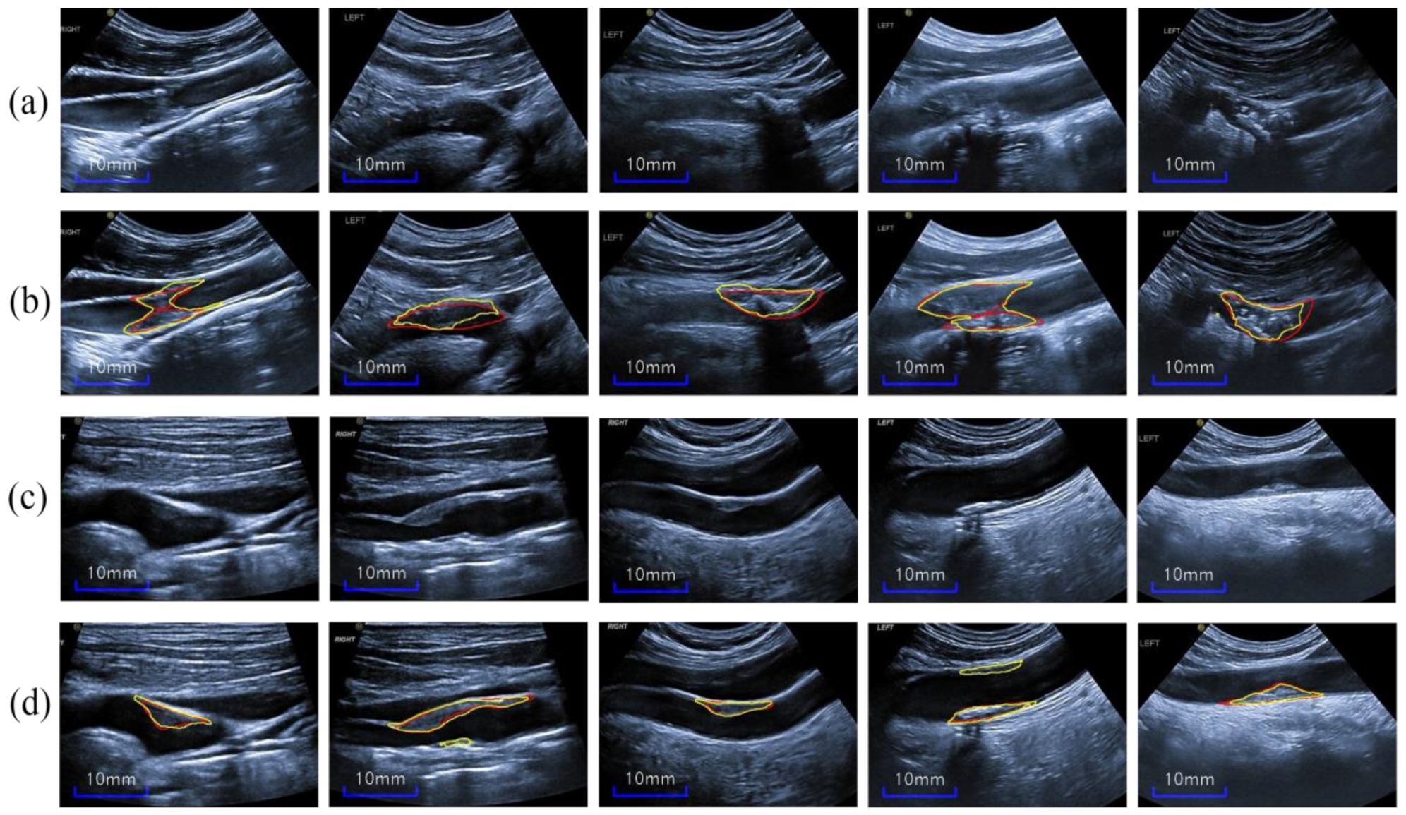 Diagnostics 12 02852 g013 Diagnostics 12 02852 g013