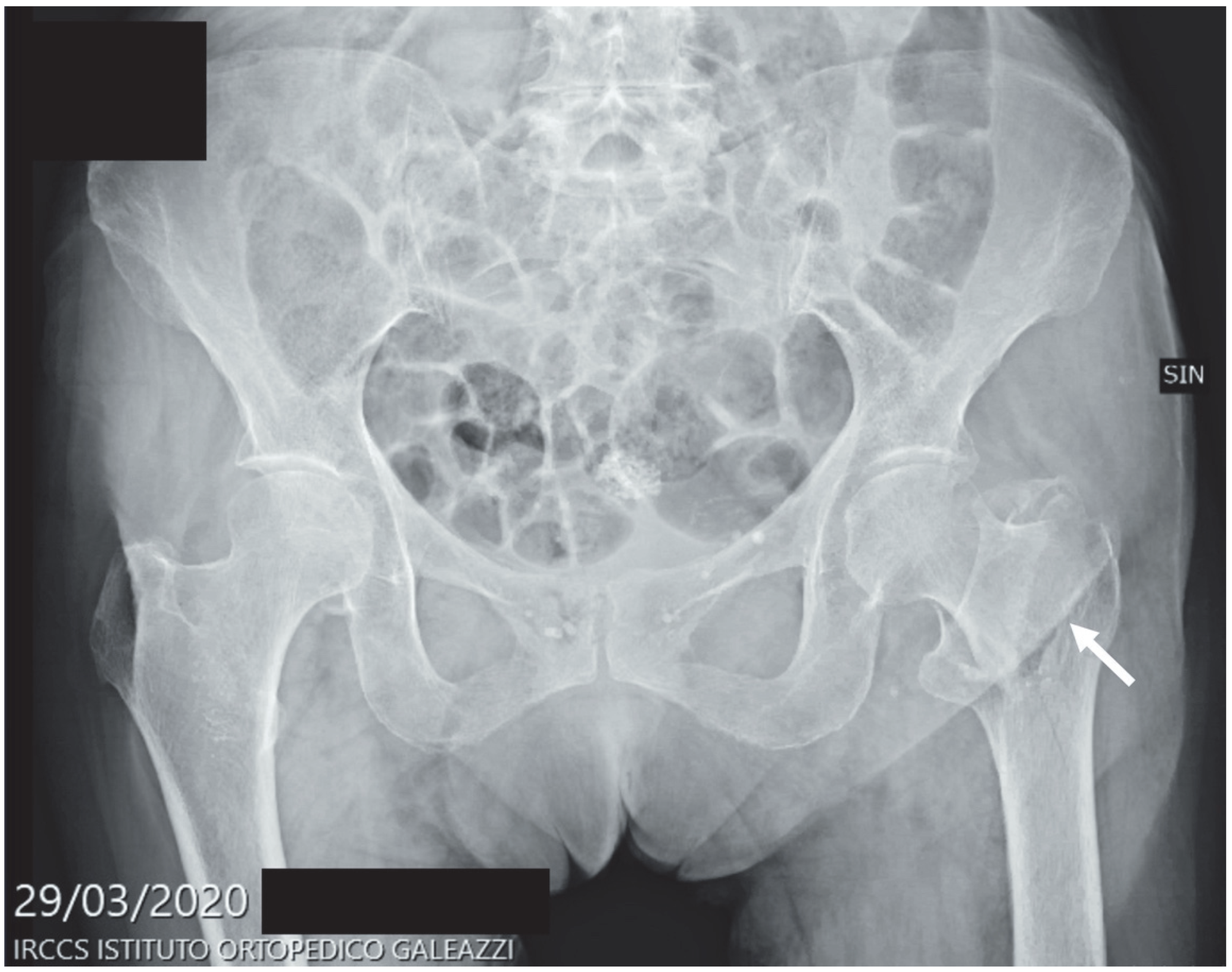 Diagnostics 12 02855 g005 Diagnostics 12 02855 g005