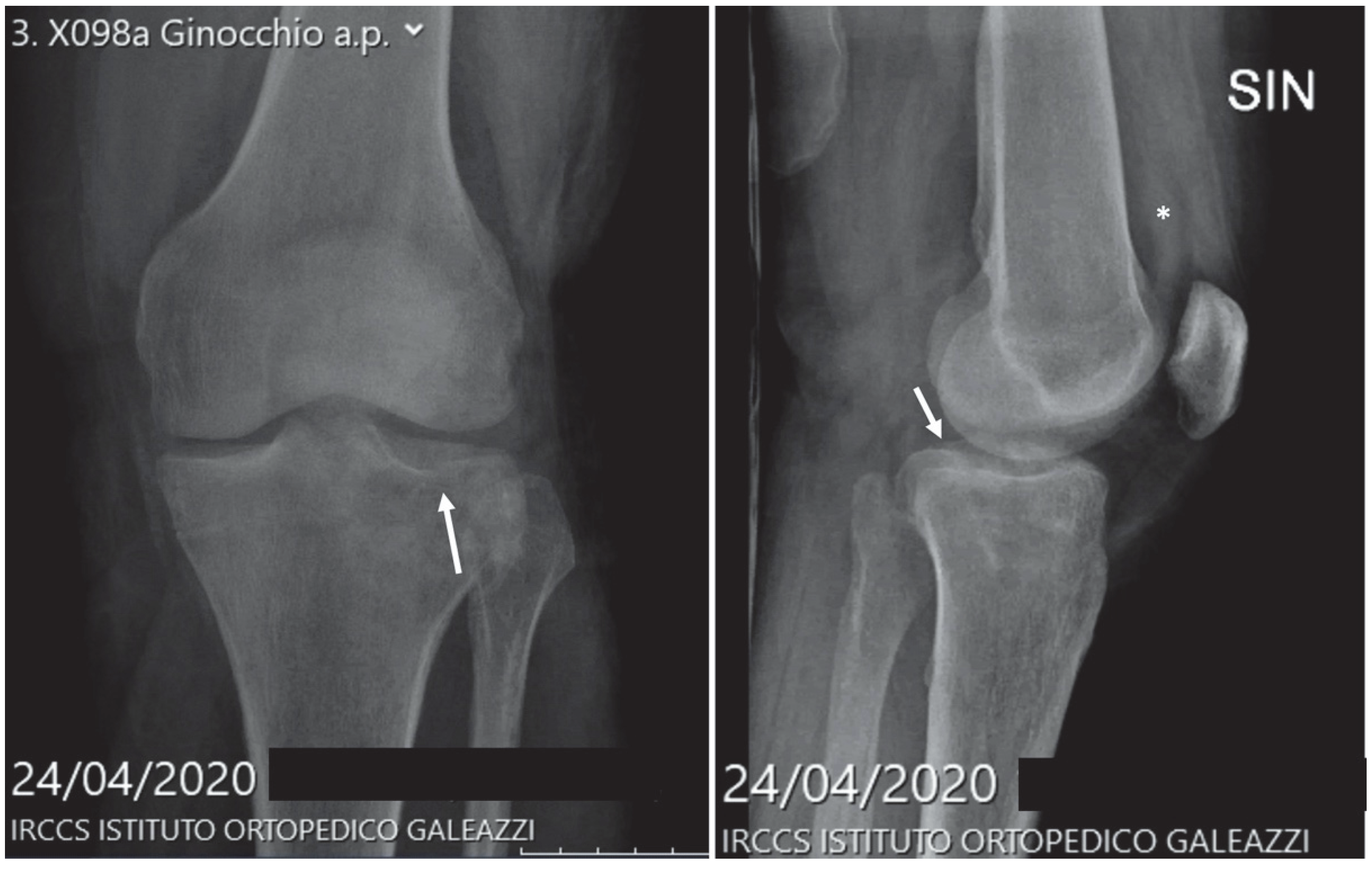 Diagnostics 12 02855 g006 Diagnostics 12 02855 g006