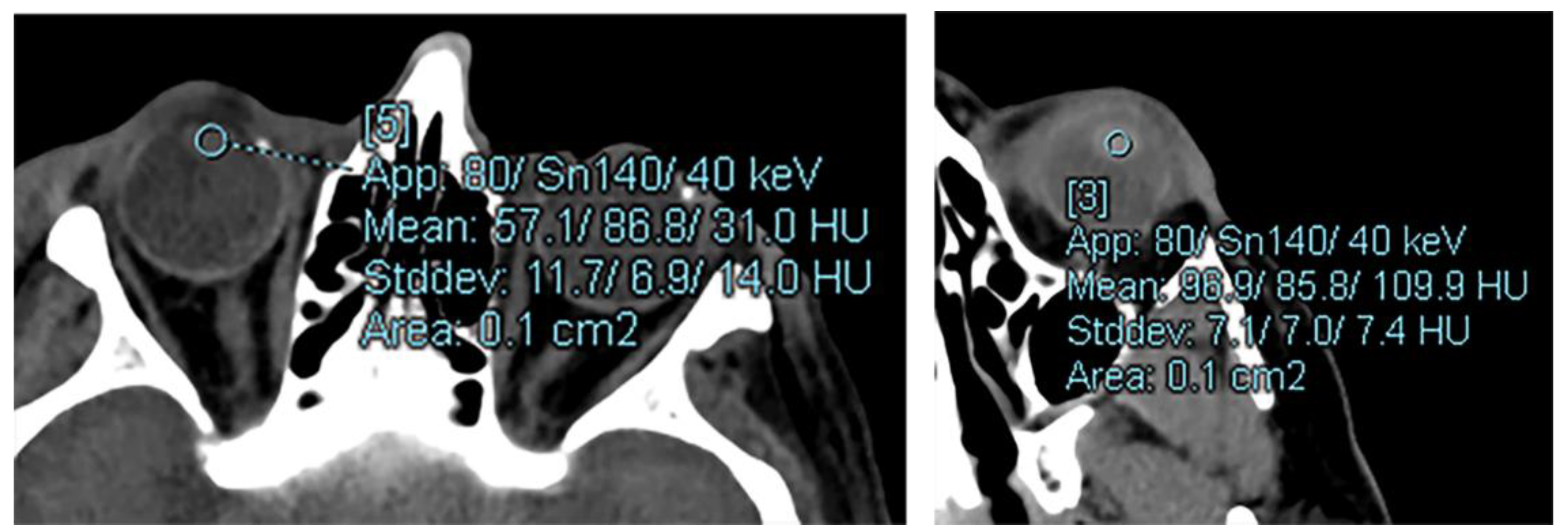 Diagnostics 12 02857 g001 Diagnostics 12 02857 g001