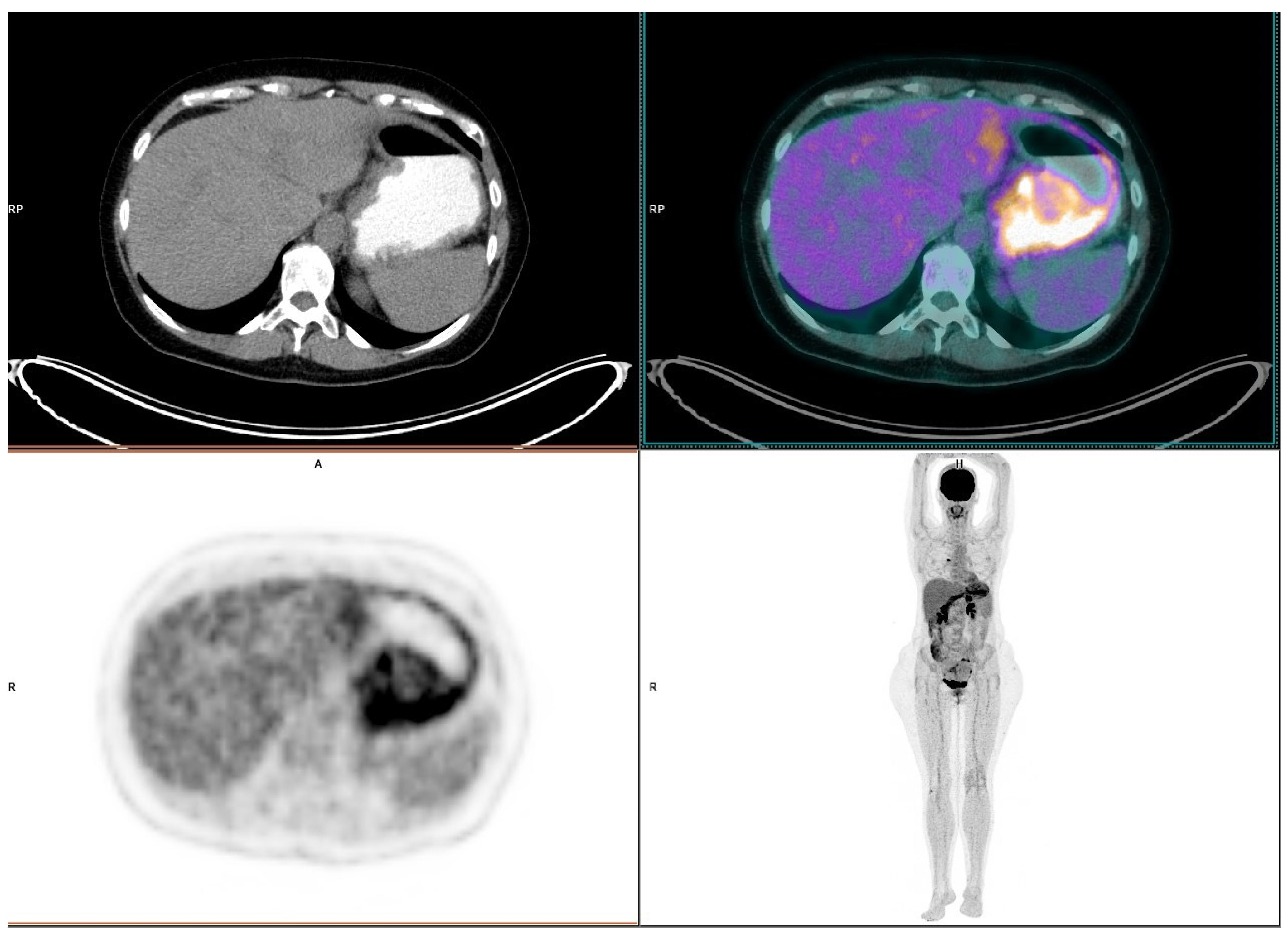 Diagnostics 12 02864 g001 Diagnostics 12 02864 g001