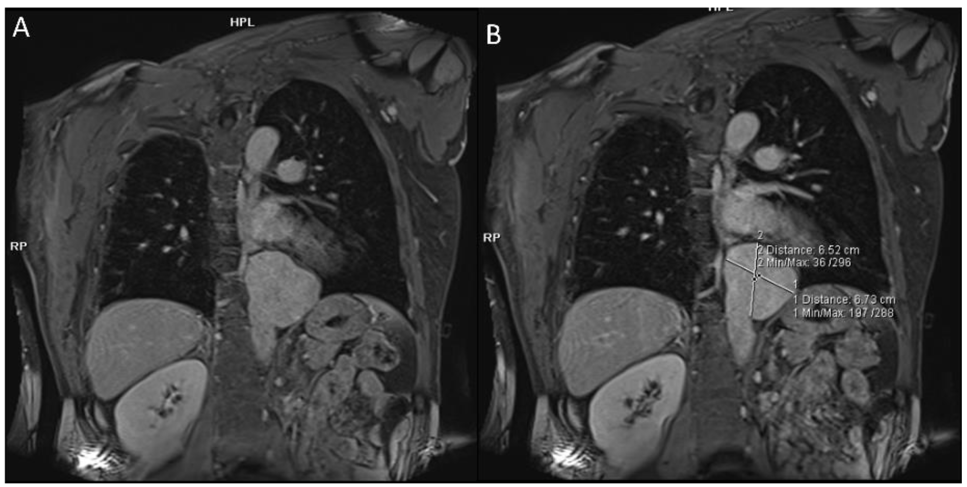 Diagnostics 12 02868 g001 Diagnostics 12 02868 g001