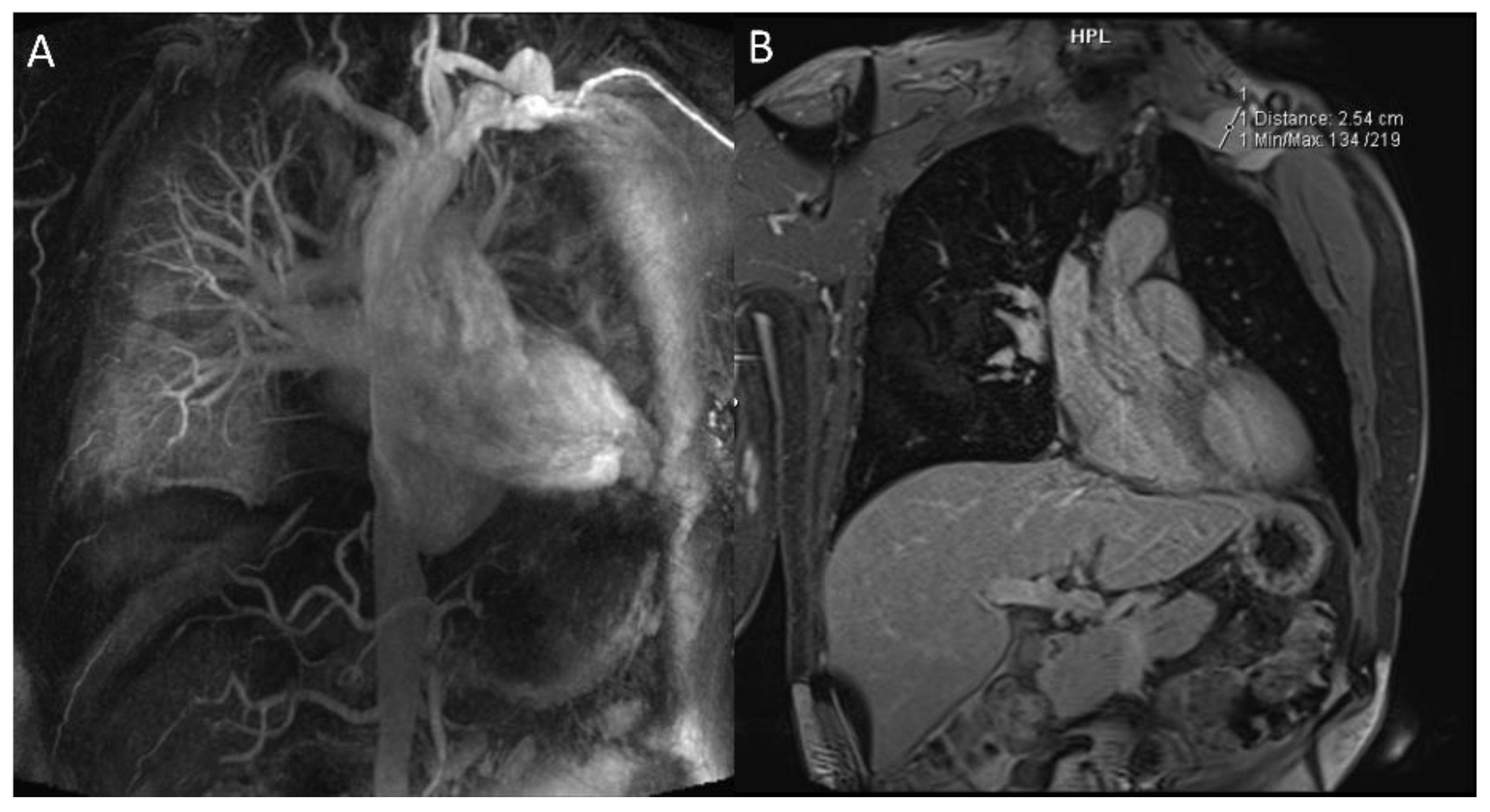 Diagnostics 12 02868 g002 Diagnostics 12 02868 g002