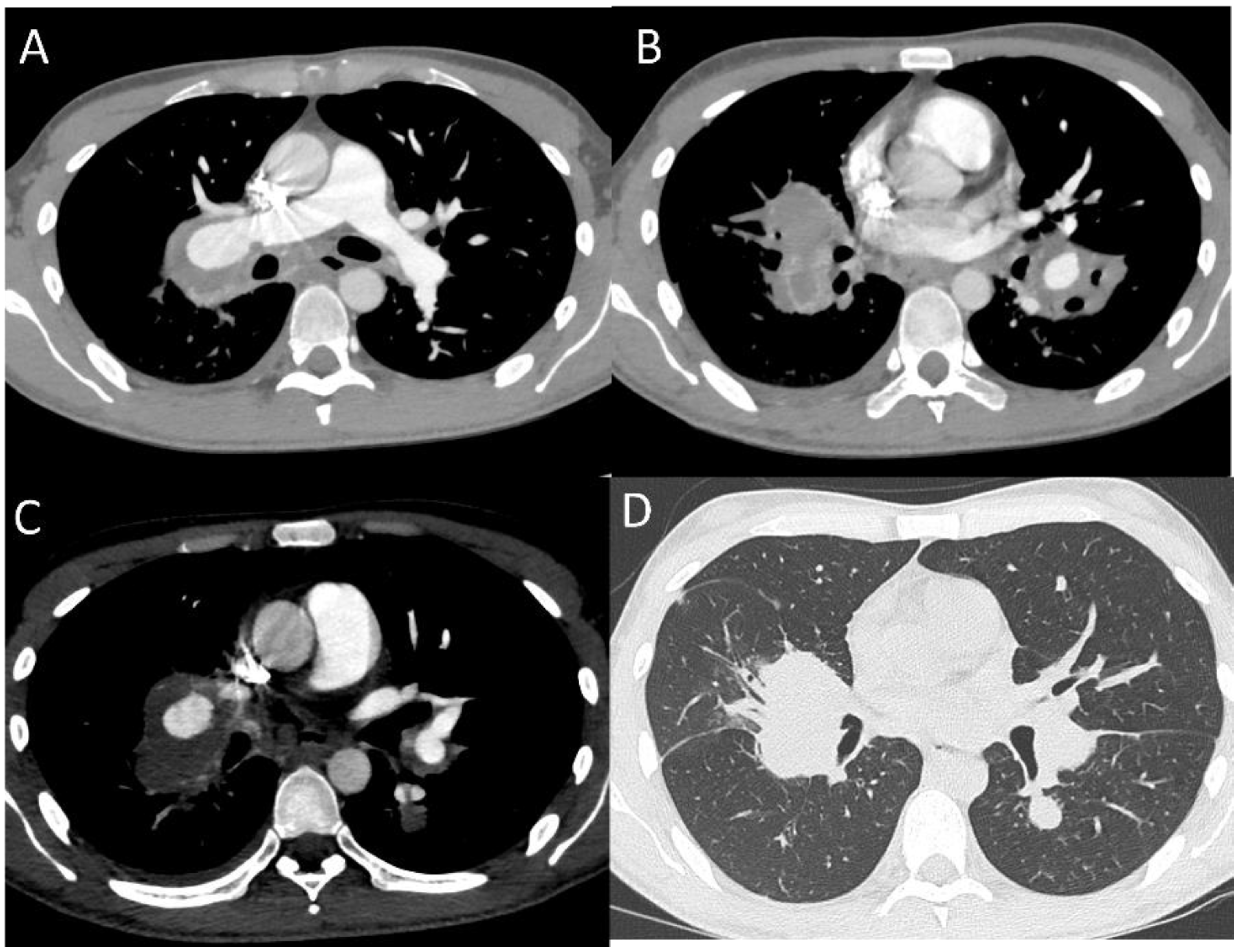 Diagnostics 12 02868 g003 Diagnostics 12 02868 g003