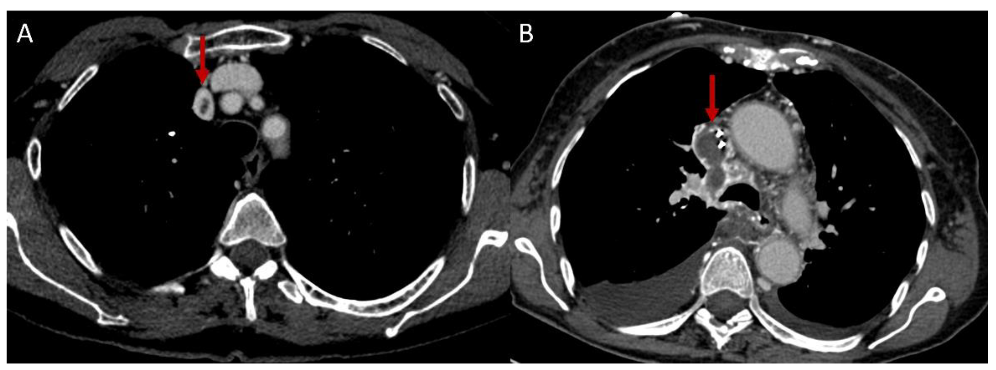 Diagnostics 12 02868 g005 Diagnostics 12 02868 g005