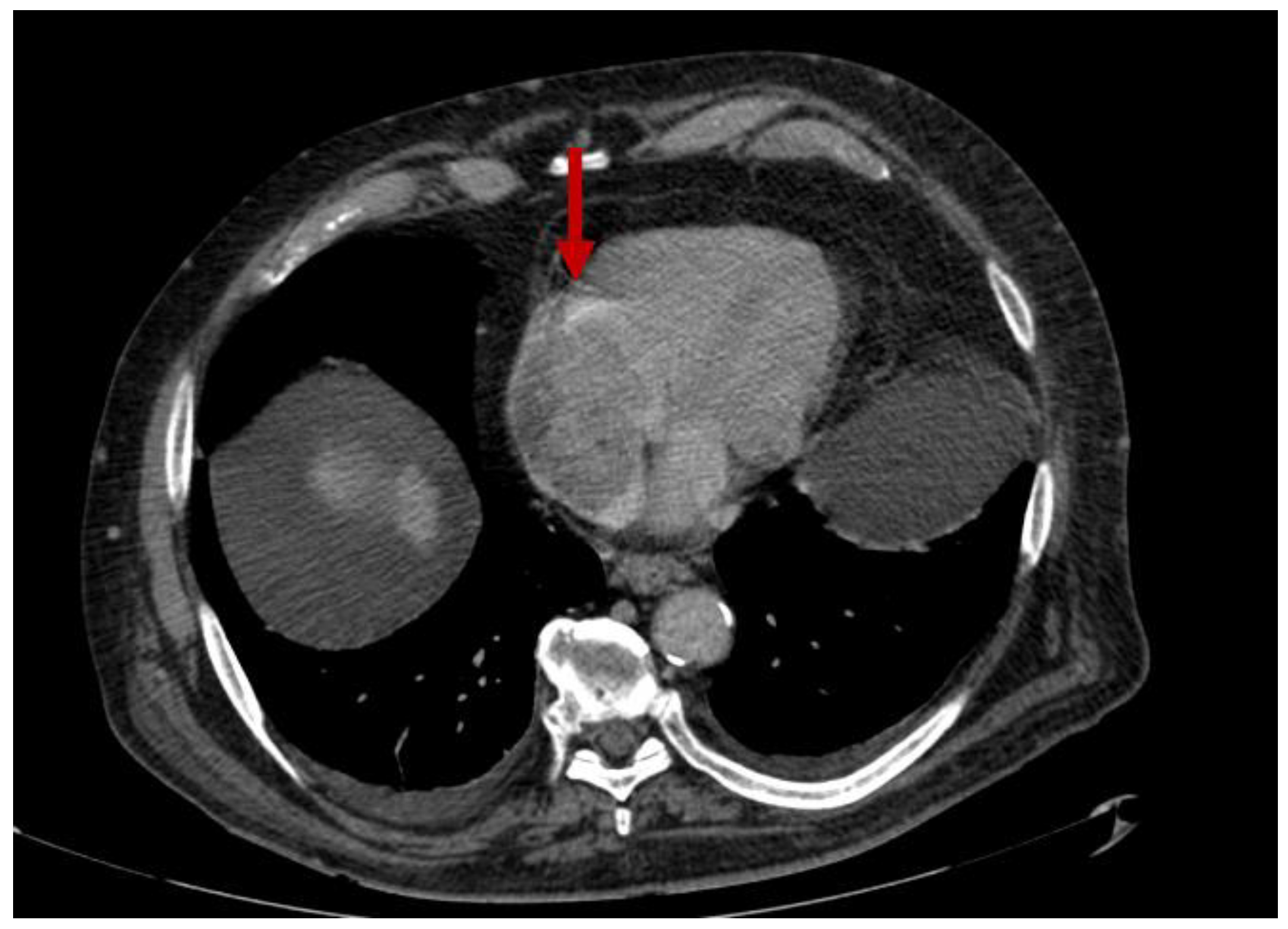 Diagnostics 12 02868 g006 Diagnostics 12 02868 g006