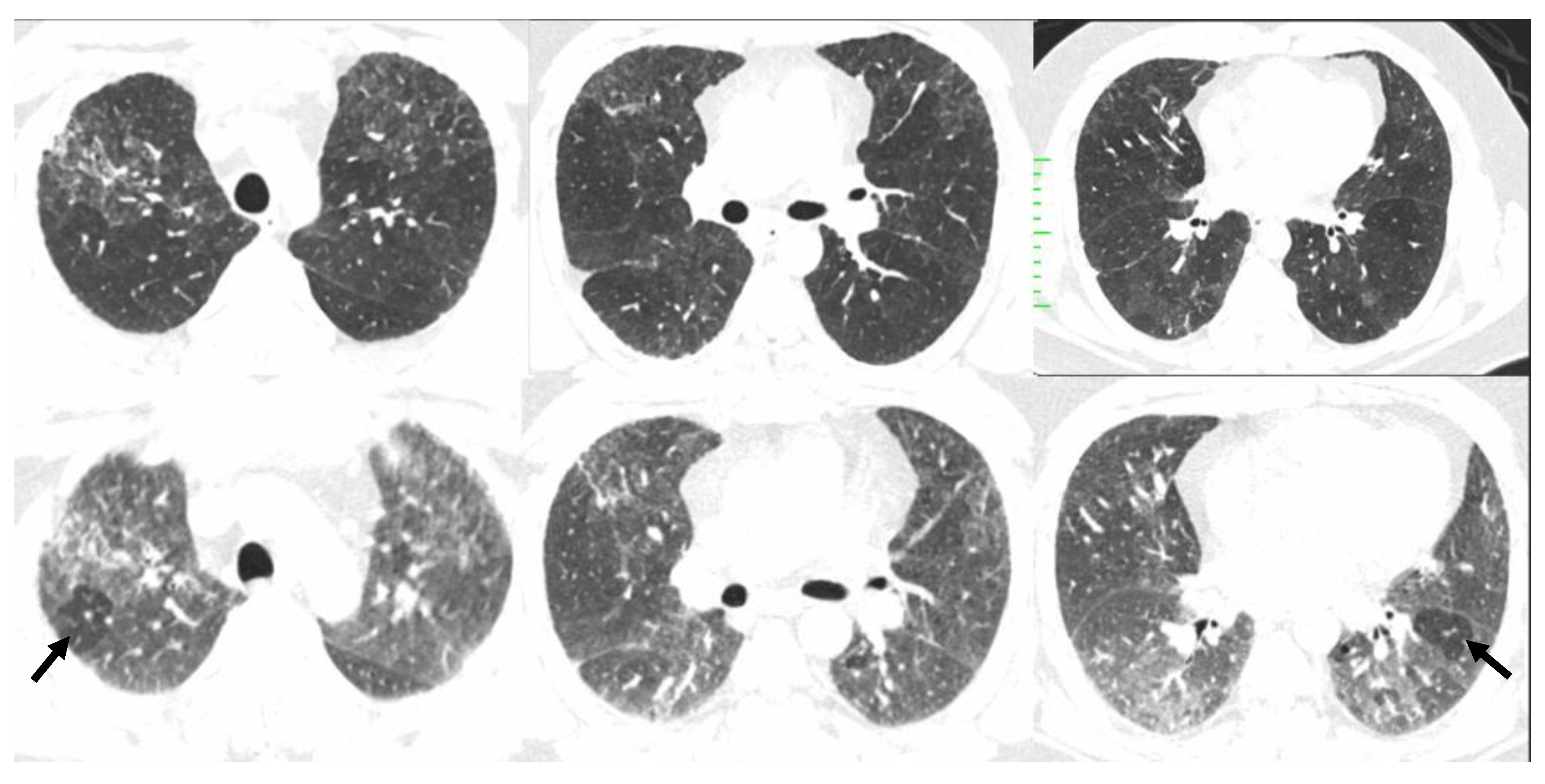 Diagnostics 12 02874 g011