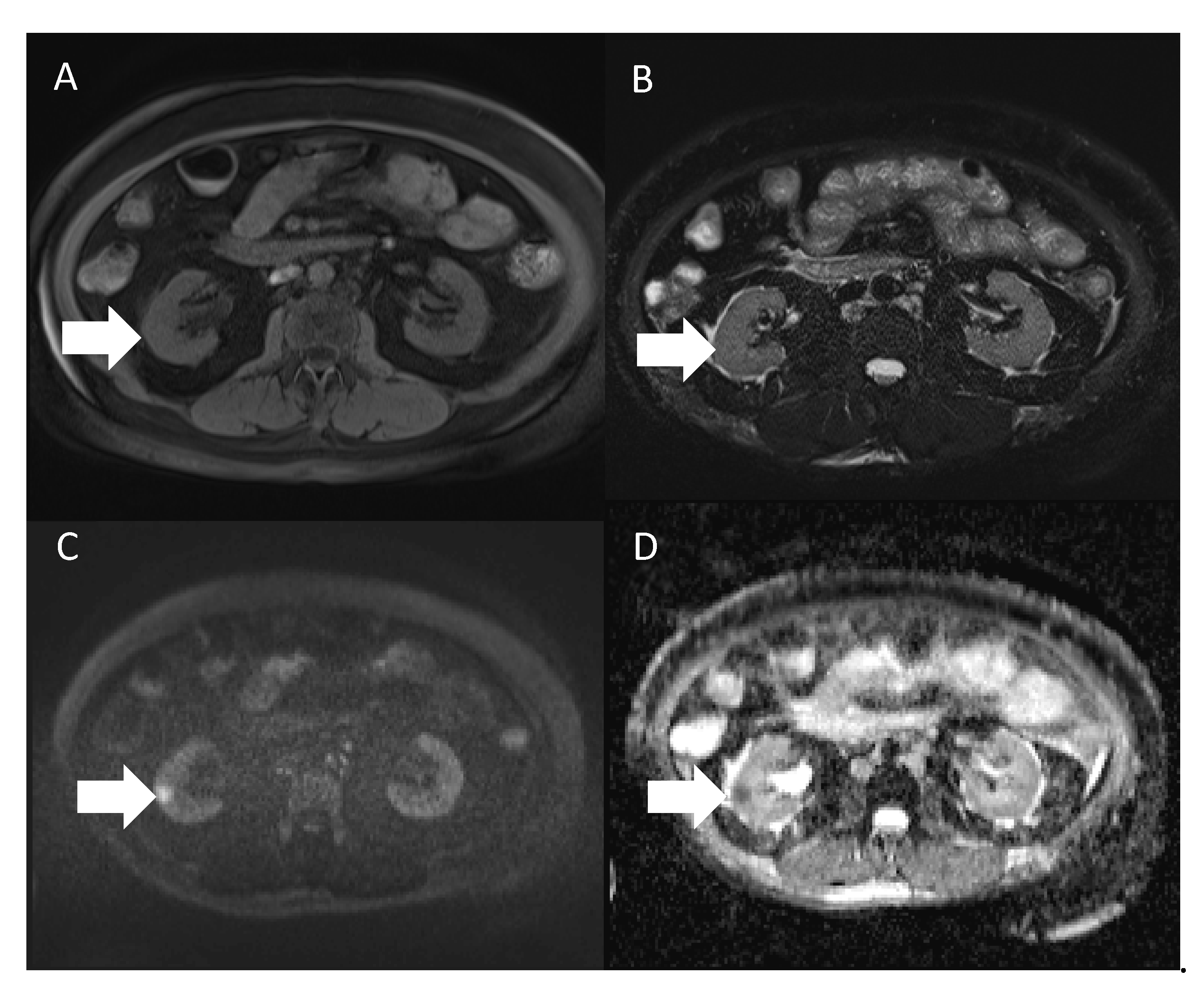 Diagnostics 12 02878 g002 Diagnostics 12 02878 g002