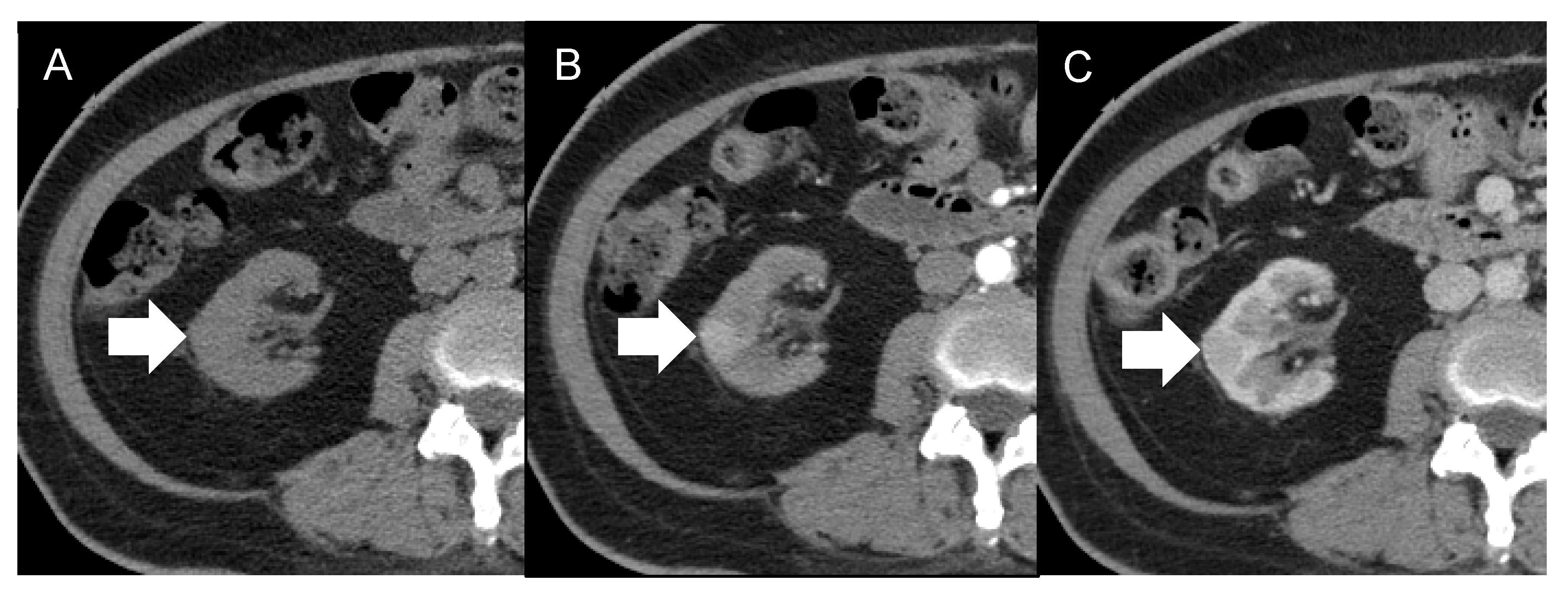 Diagnostics 12 02878 g003 Diagnostics 12 02878 g003