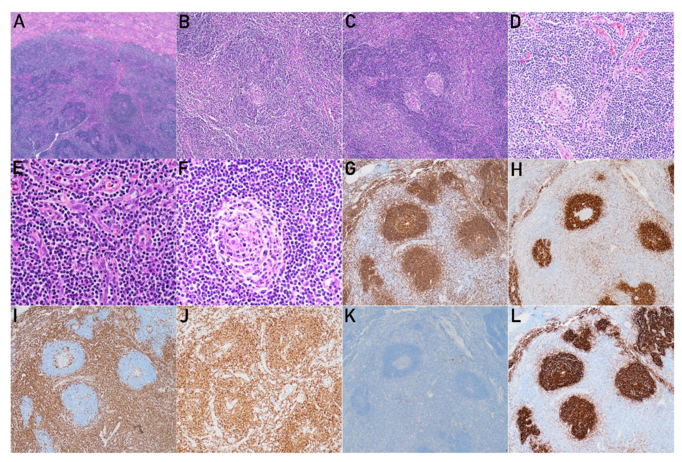 Diagnostics 12 02878 g004 Diagnostics 12 02878 g004