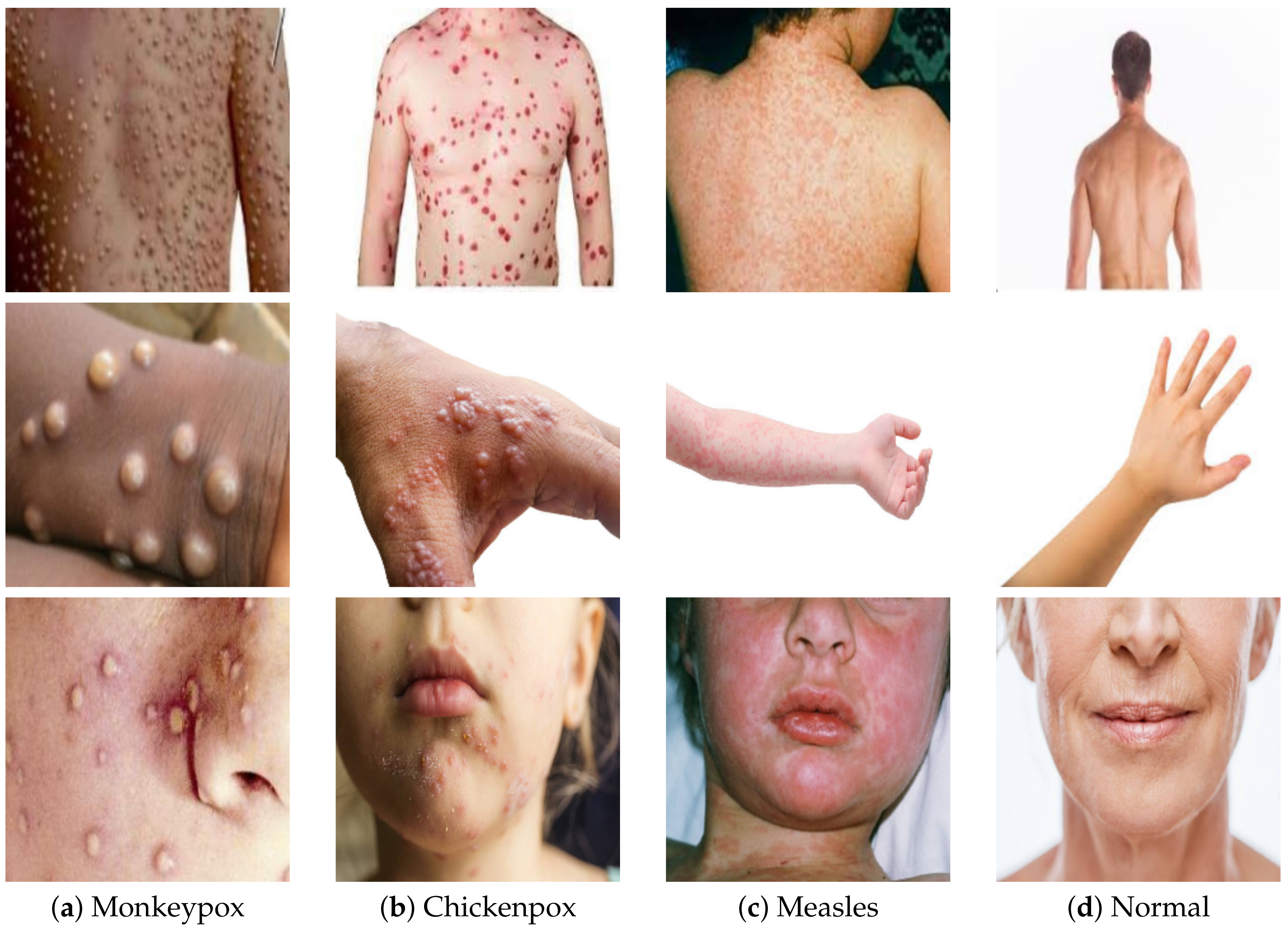 Diagnostics 12 02892 g001 Diagnostics 12 02892 g001