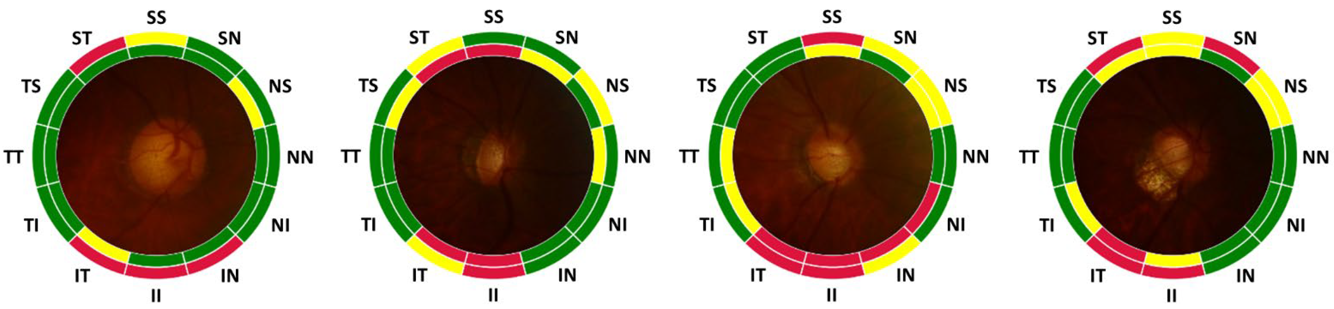 Diagnostics 12 02894 g008 Diagnostics 12 02894 g008