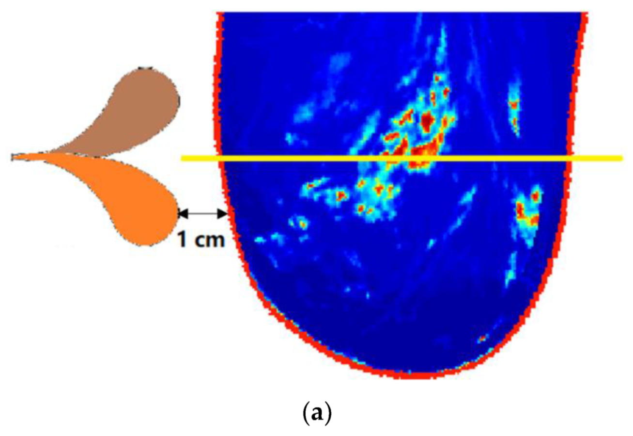 Diagnostics 12 02906 g005a Diagnostics 12 02906 g005a