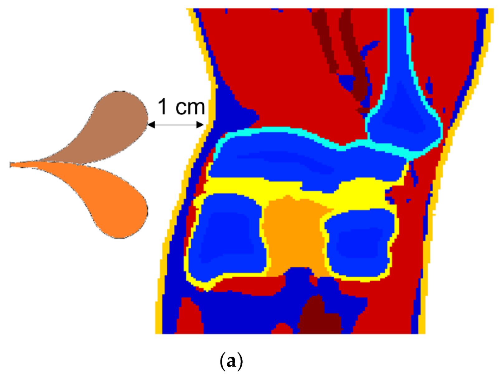 Diagnostics 12 02906 g006a Diagnostics 12 02906 g006a